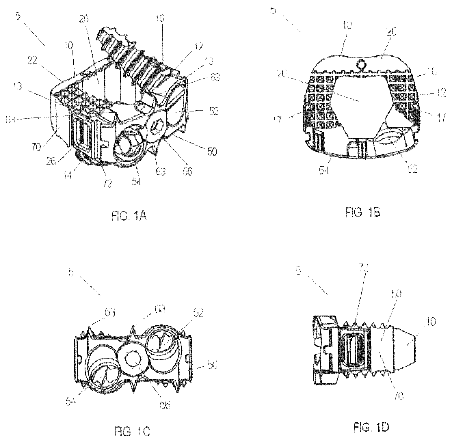 Patent US12303398 — Low profile plate — Figure 1