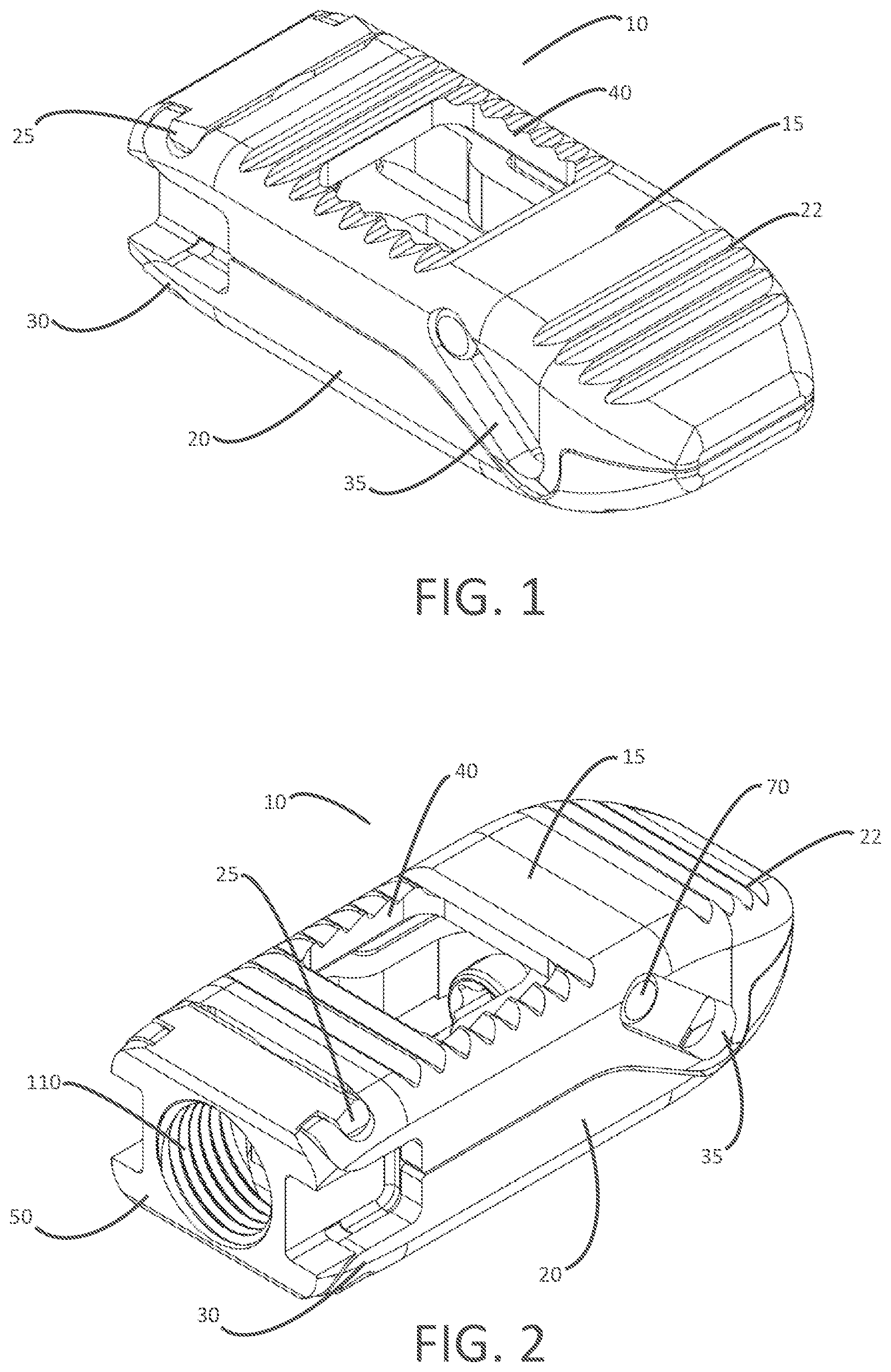 Patent US12303399 — Expandable lordotic interbodies and related methods — Figure 1