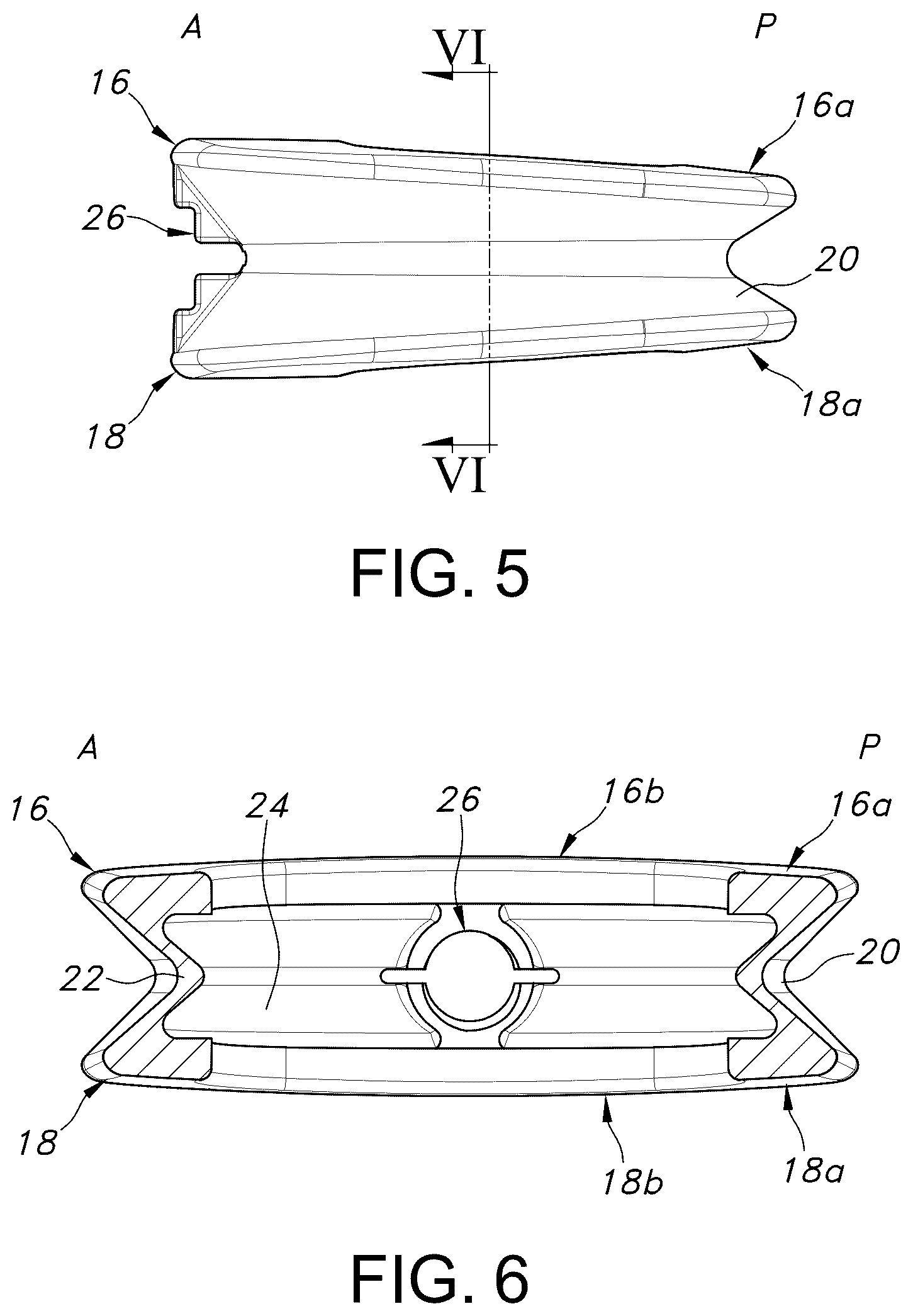 Patent US12303402 Figure 4 – Spinal interbody fusion device