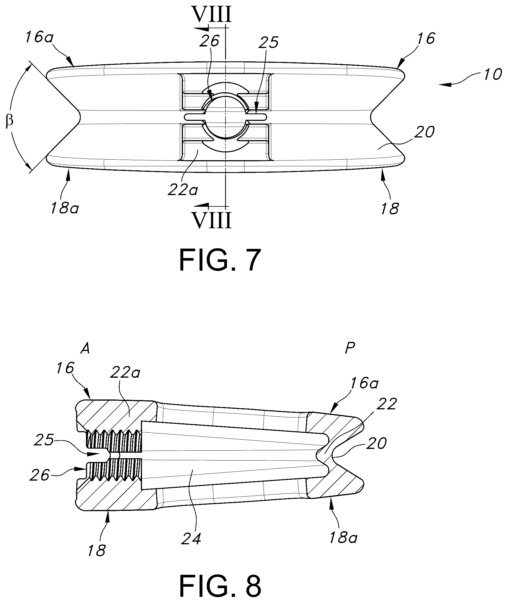 Patent US12303402 Figure 5 – Spinal interbody fusion device