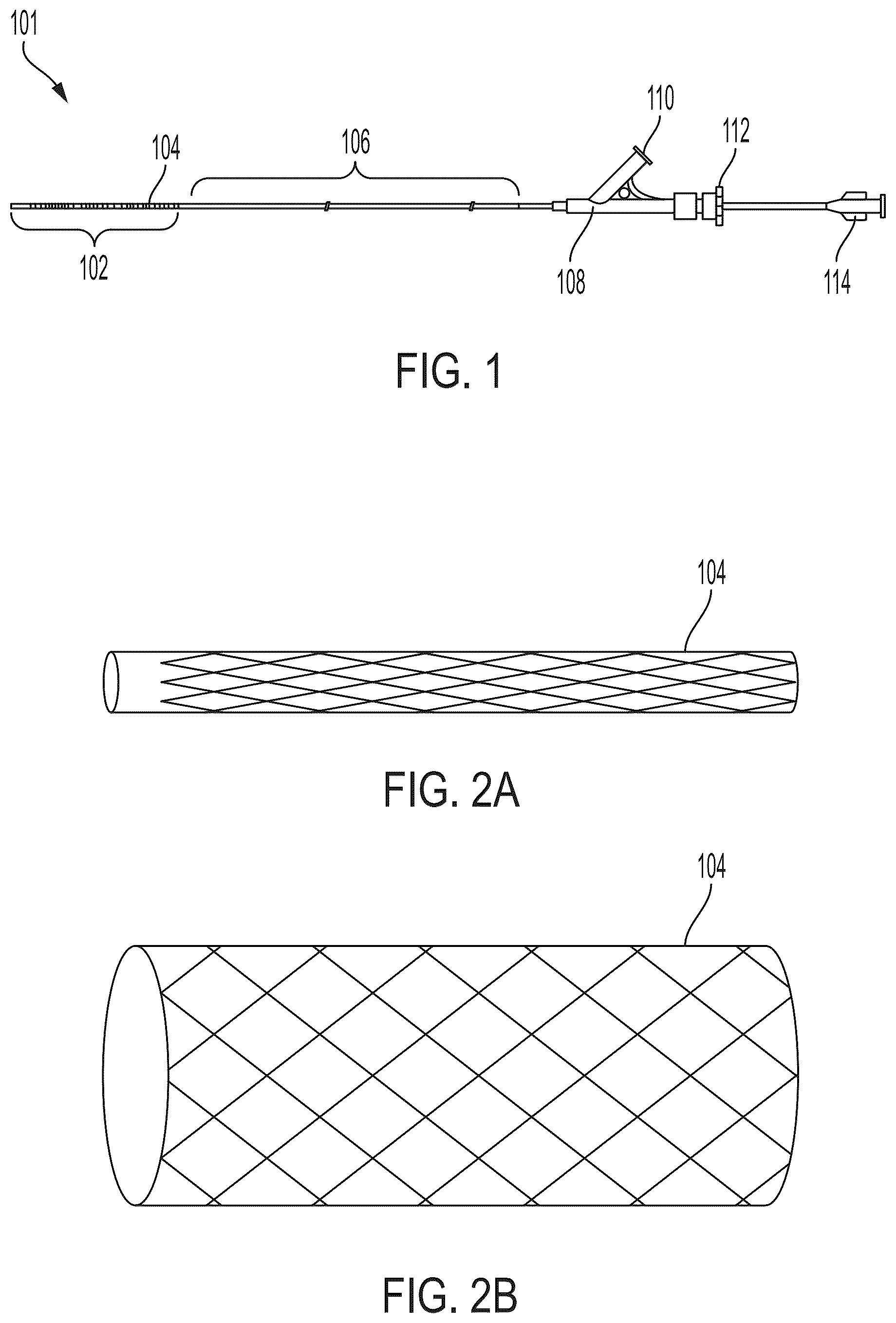 Patent US12303410 — Stent device with stent covering with regions of differing porosity — Figure 1