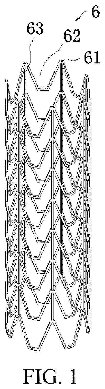 Patent US12303411 — Left ventricular outflow tract stent and delivery system — Figure 1