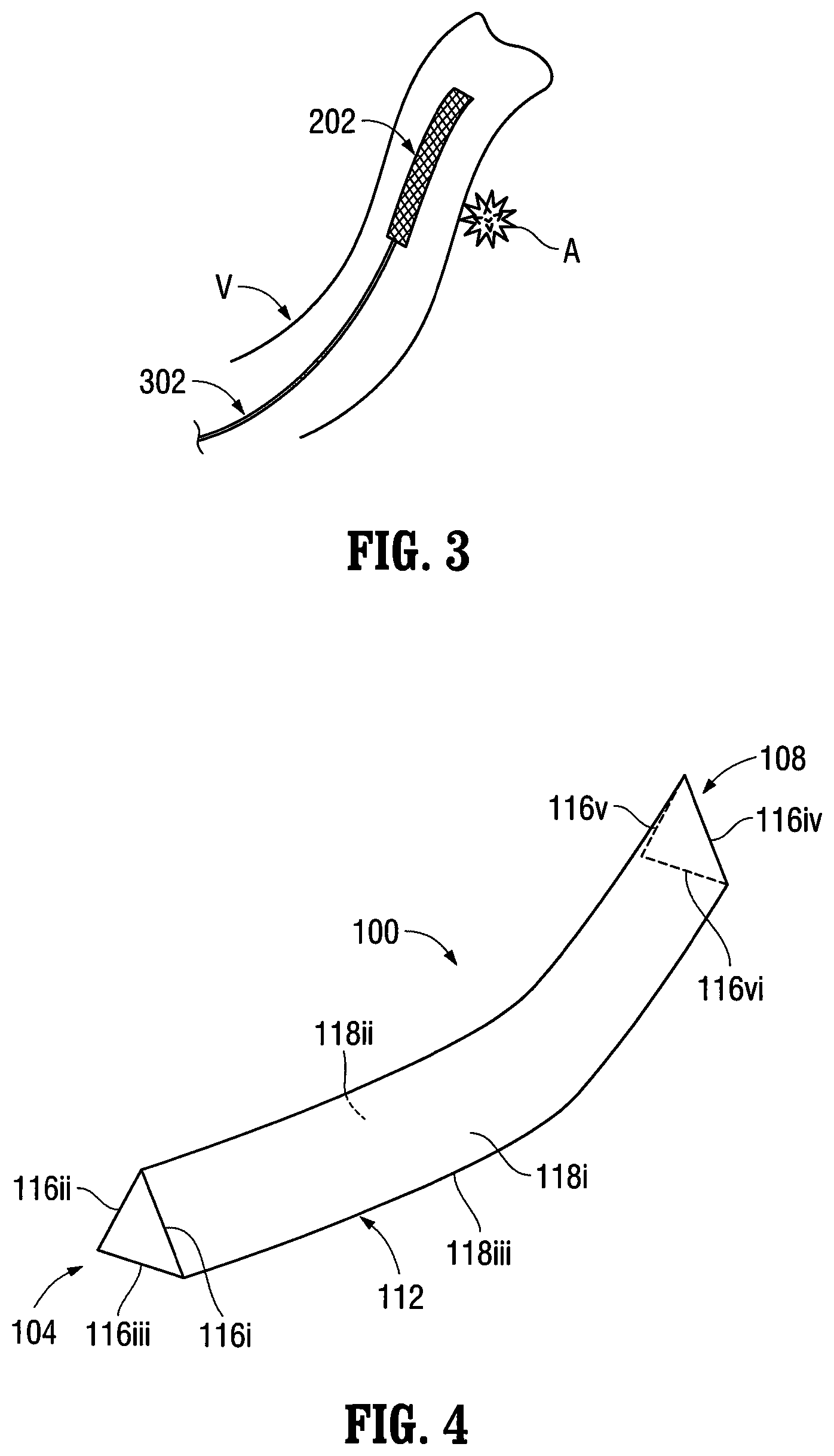 Patent US12303412 Figure 5 – Orientable implantable device and method