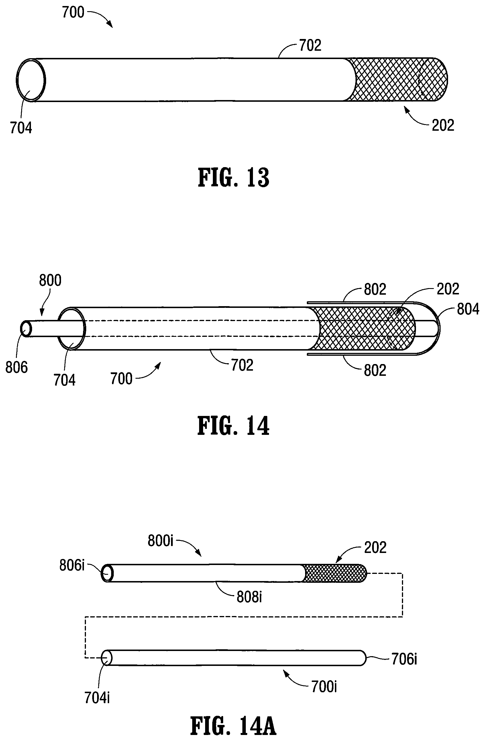 Patent US12303412 Figure 9 – Orientable implantable device and method