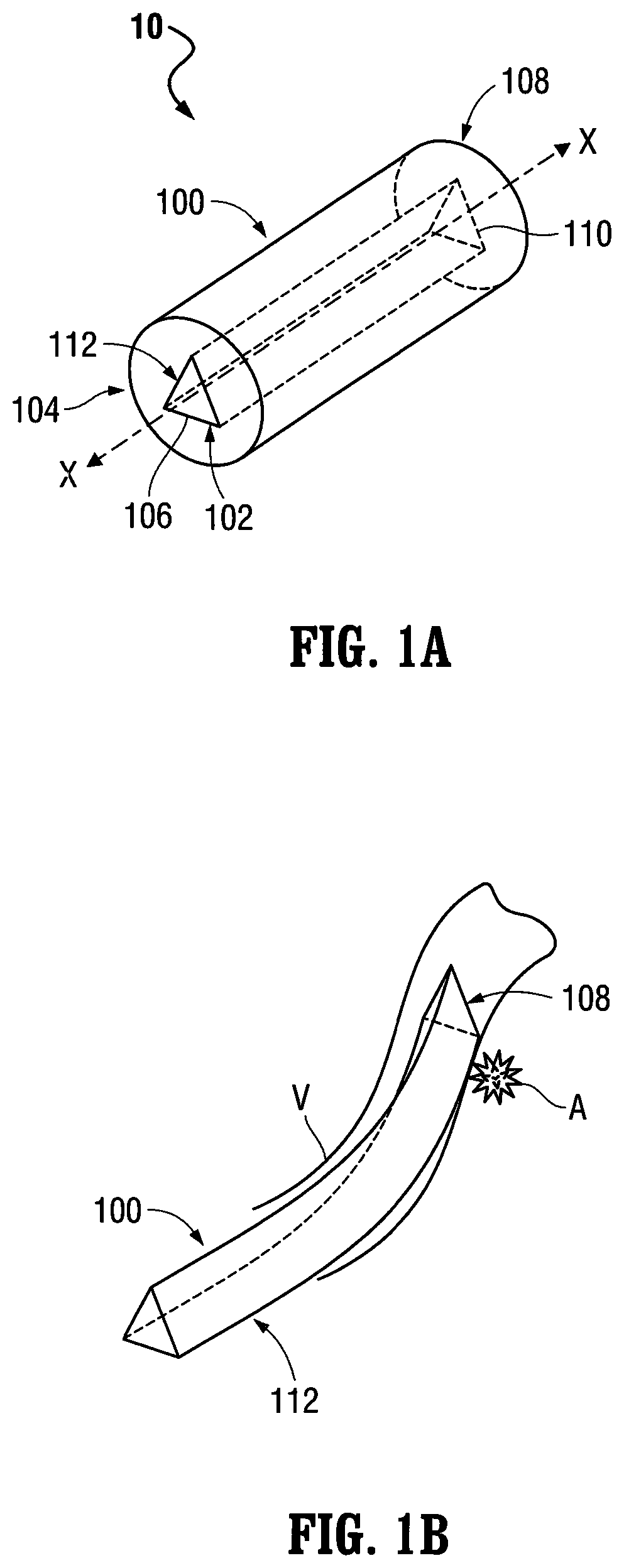 Patent US12303413 Figure 1 – Orientable implantable device and method