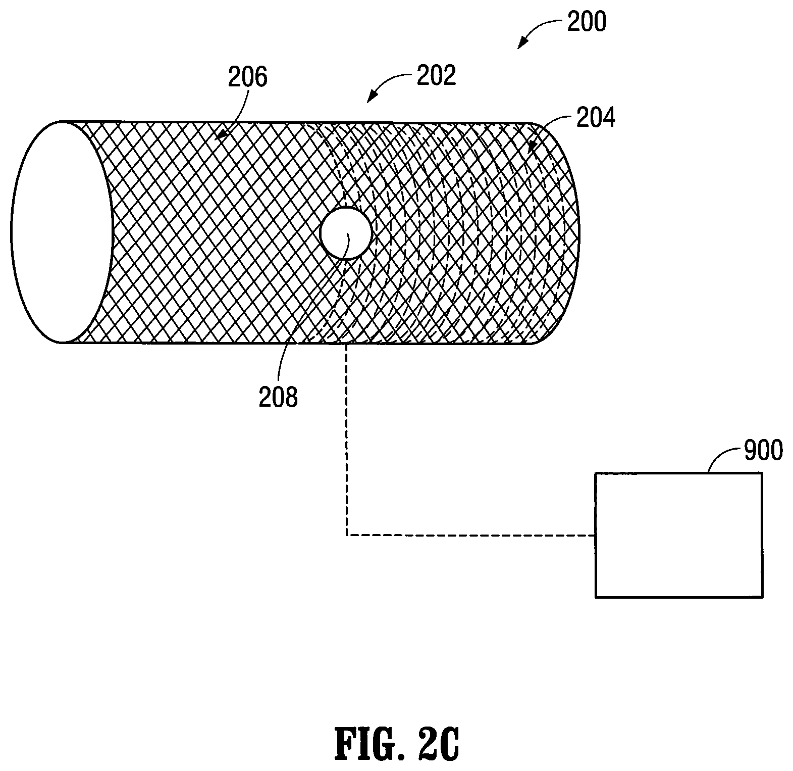 Patent US12303413 Figure 4 – Orientable implantable device and method