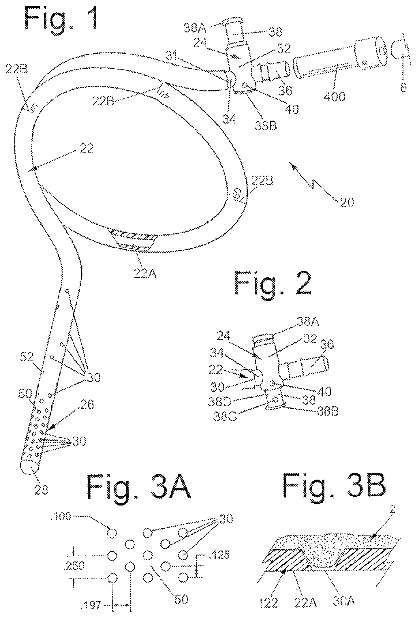 Patent US12303415 — Systems and methods for performing bariatric surgery — Figure 1