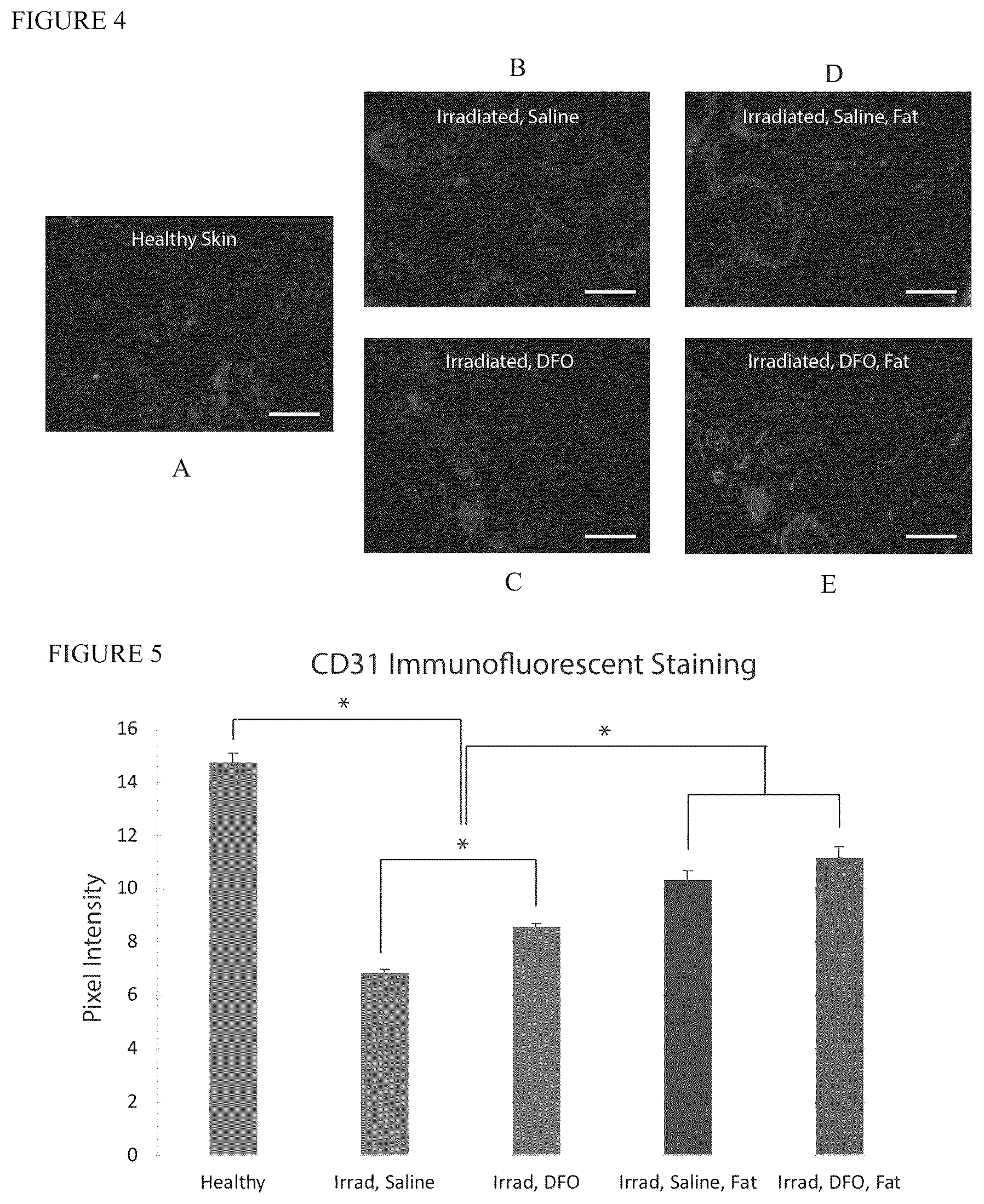 Patent US12303475 Figure 4 – Conditioning irradiated tissue for increasing vascularity