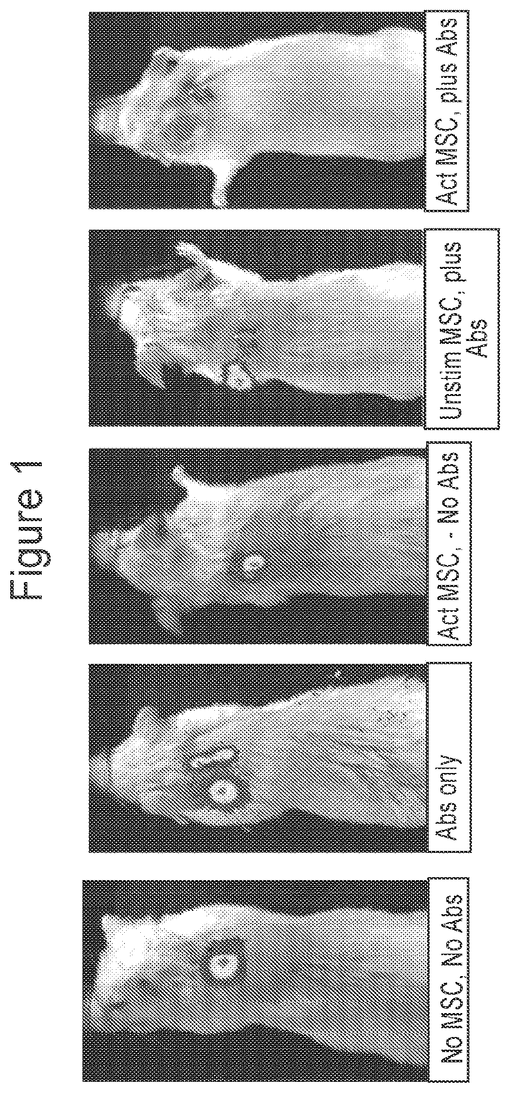 Patent US12303535 — Activated stem cells and systemic treatment methods for infected wounds — Figure 1