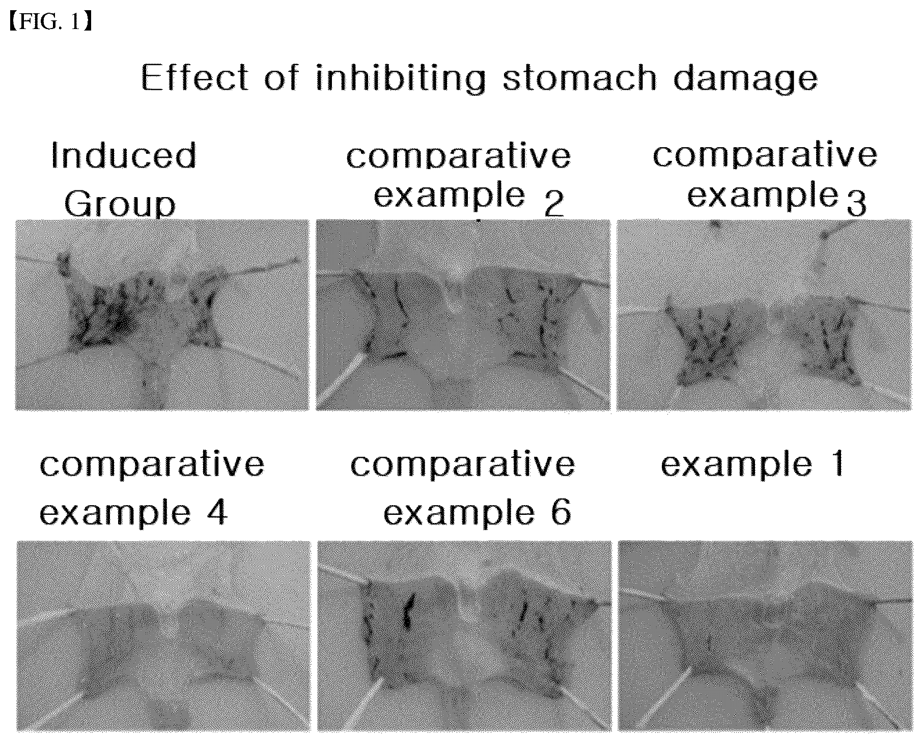 Patent US12303543 — Composition for preventing or treating gastritis or peptic ulcer — Figure 1