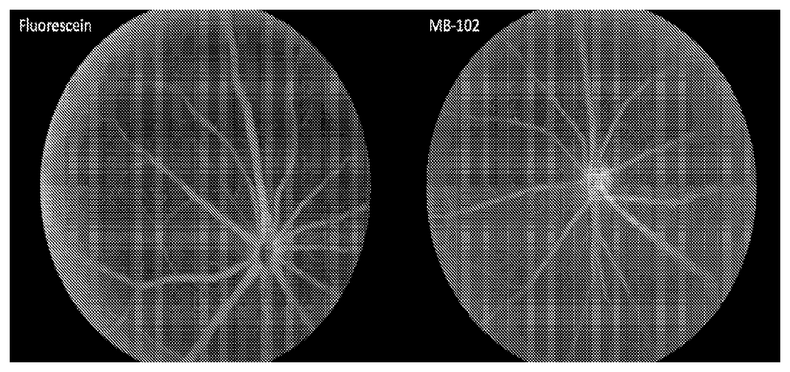 Patent US12303570 — Compositions and methods for assessing eye vasculature — Figure 1