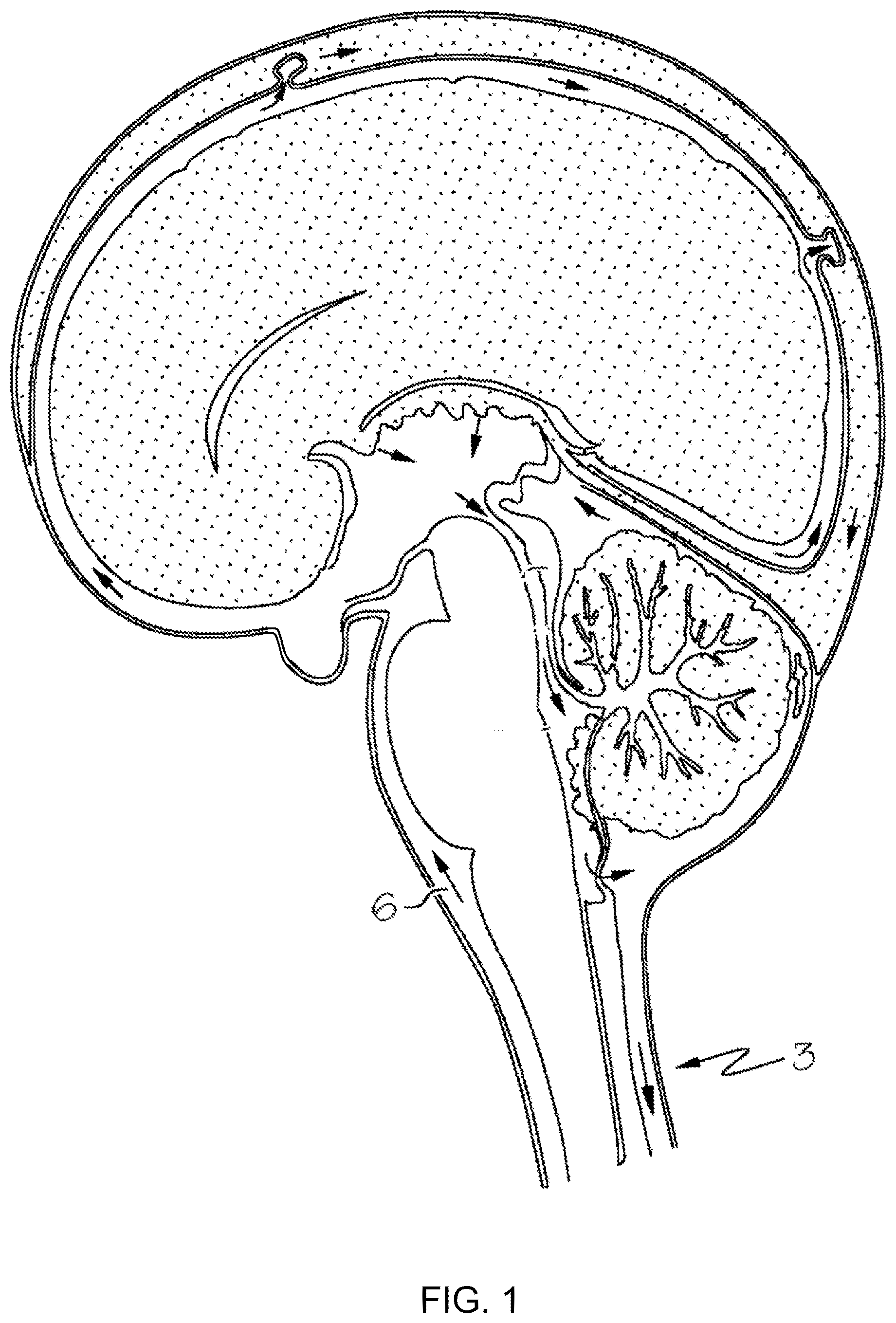 Patent US12303595 — Methods of administering anti-epilepsy agents and transport inhibitors to a subject — Figure 1