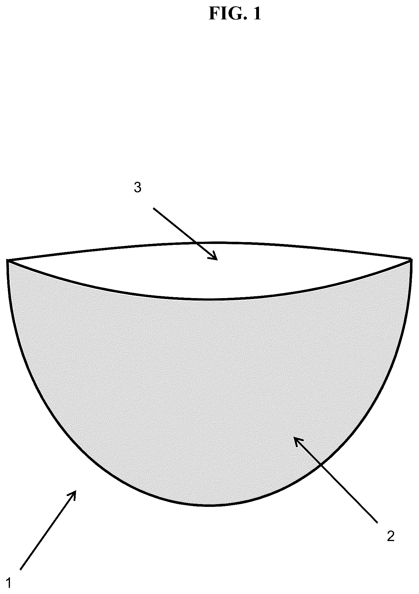 Patent US12303612 — Soft tissue implant pocket — Figure 1