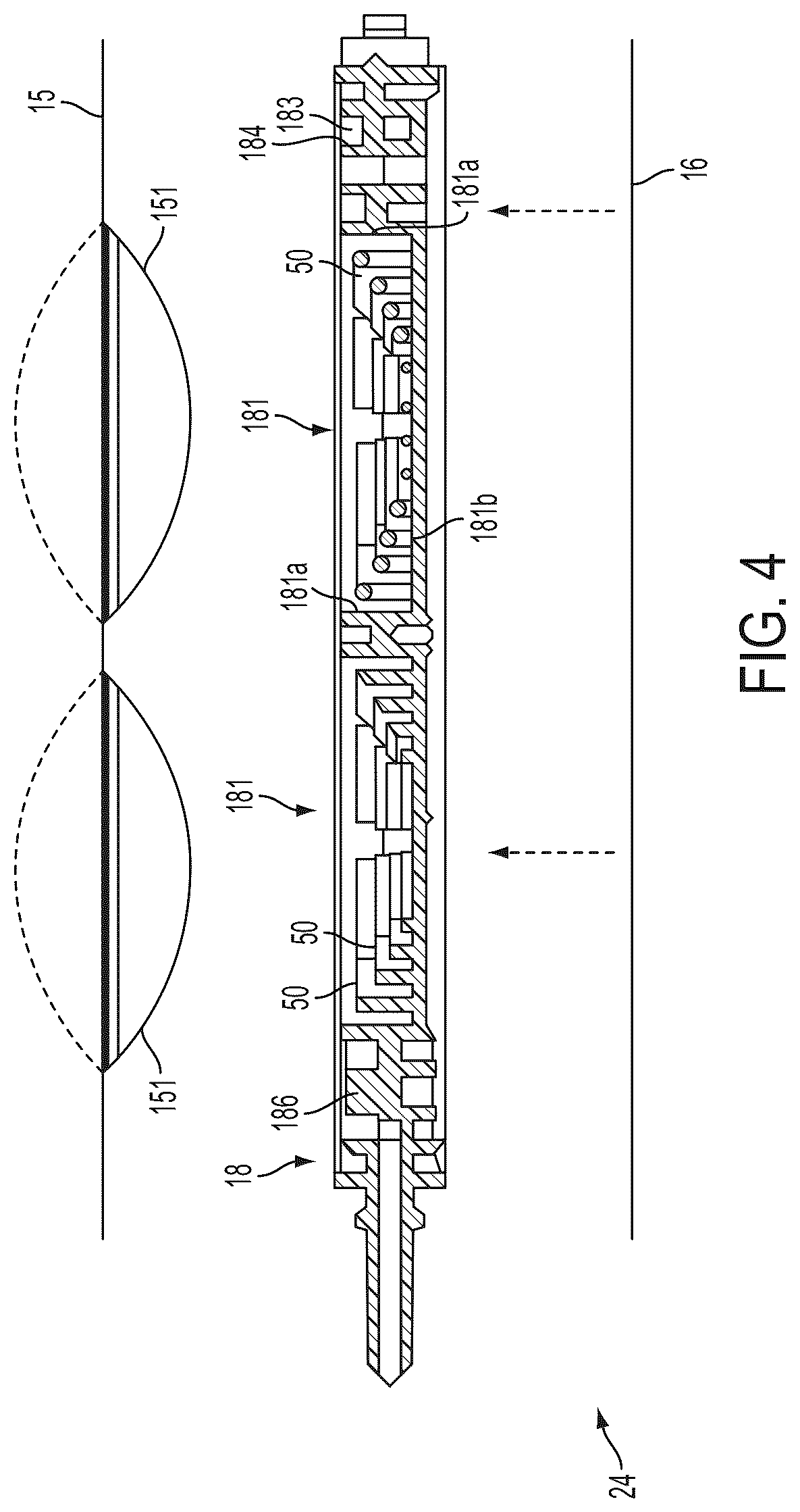 Patent US12303631 Figure 5 – Medical treatment system and methods using a plurality of fluid lines