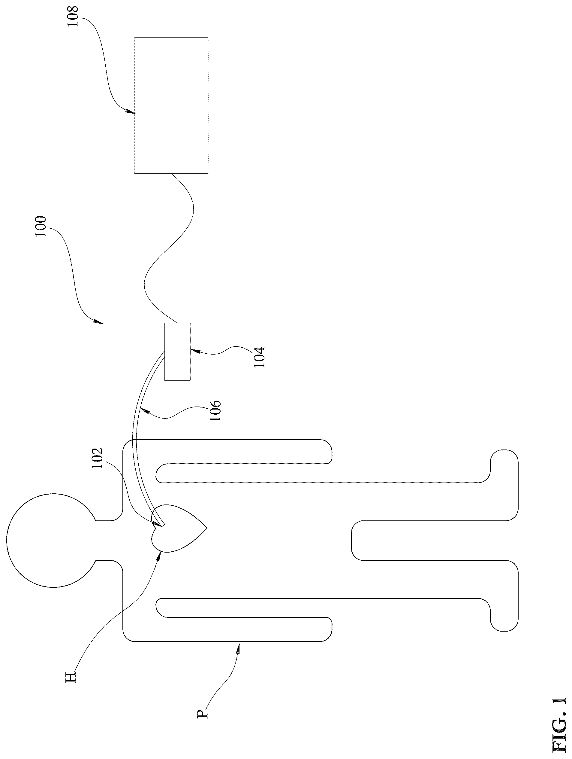 Patent US12303679 — Expandable mechanical hemodynamic support systems, devices, and methods — Figure 1