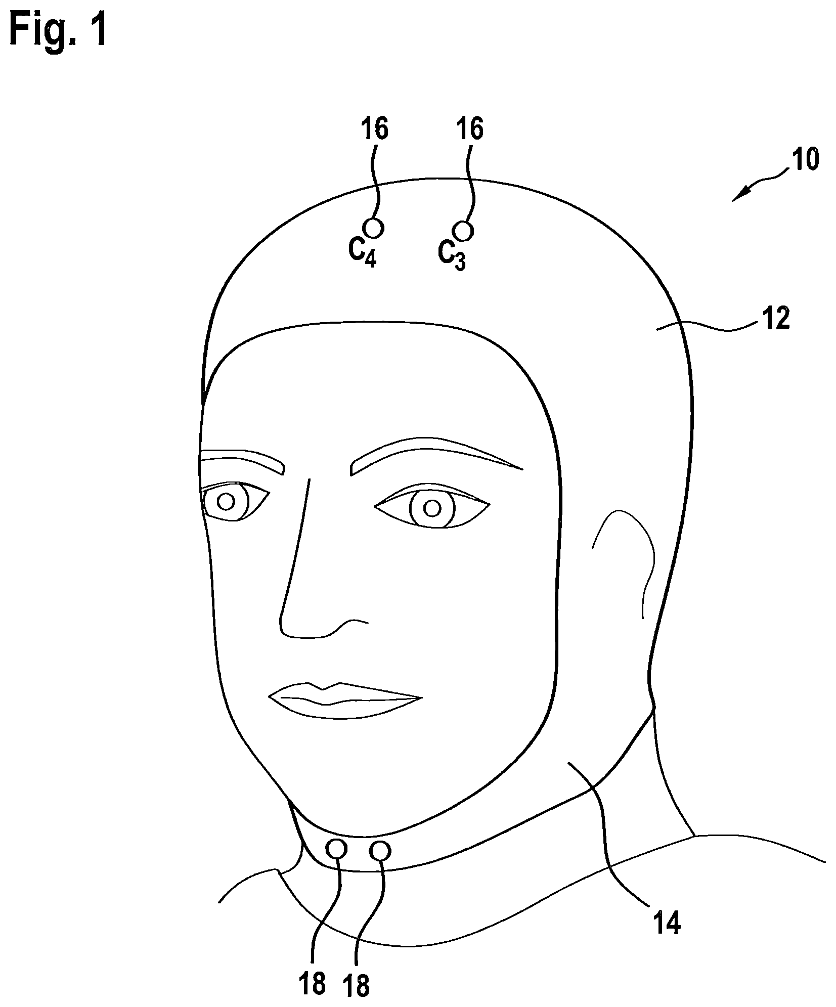 Patent US12303691 — Device and method for determining sleep apnea — Figure 1