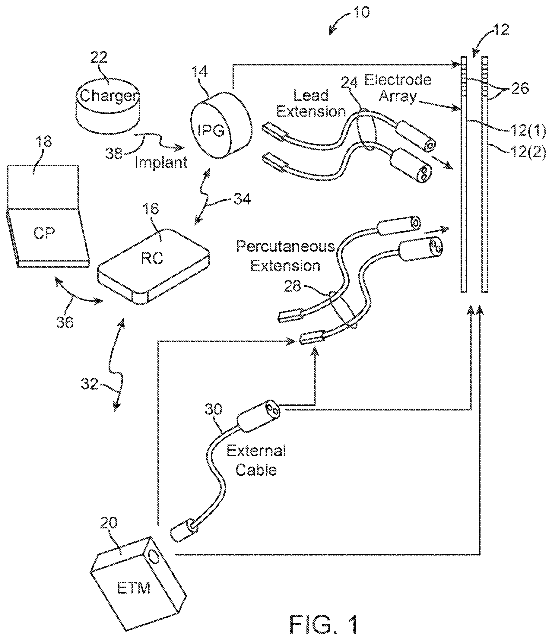 Patent US12303695 — Systems and methods of providing modulation therapy without patient-perception of stimulation — Figure 1