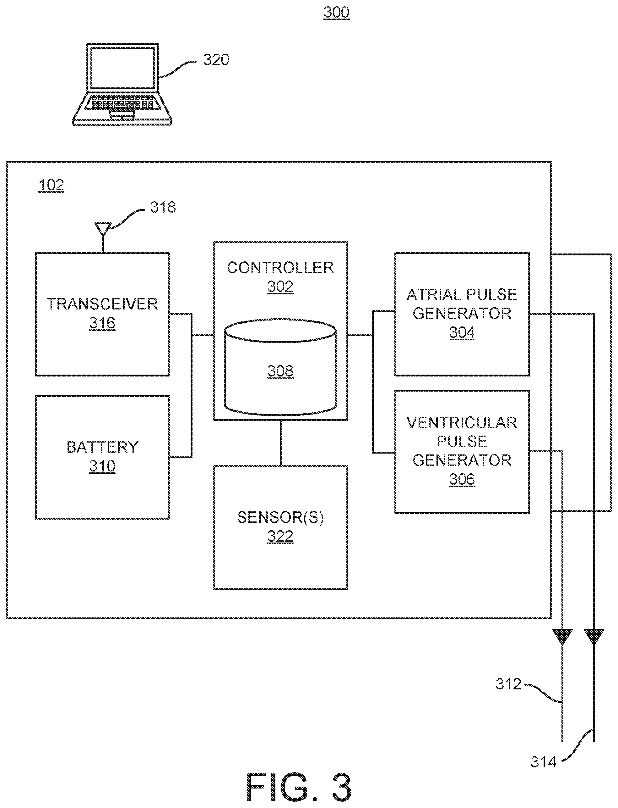 Patent US12303696 Figure 3 – Cardiac pacing sensing and control