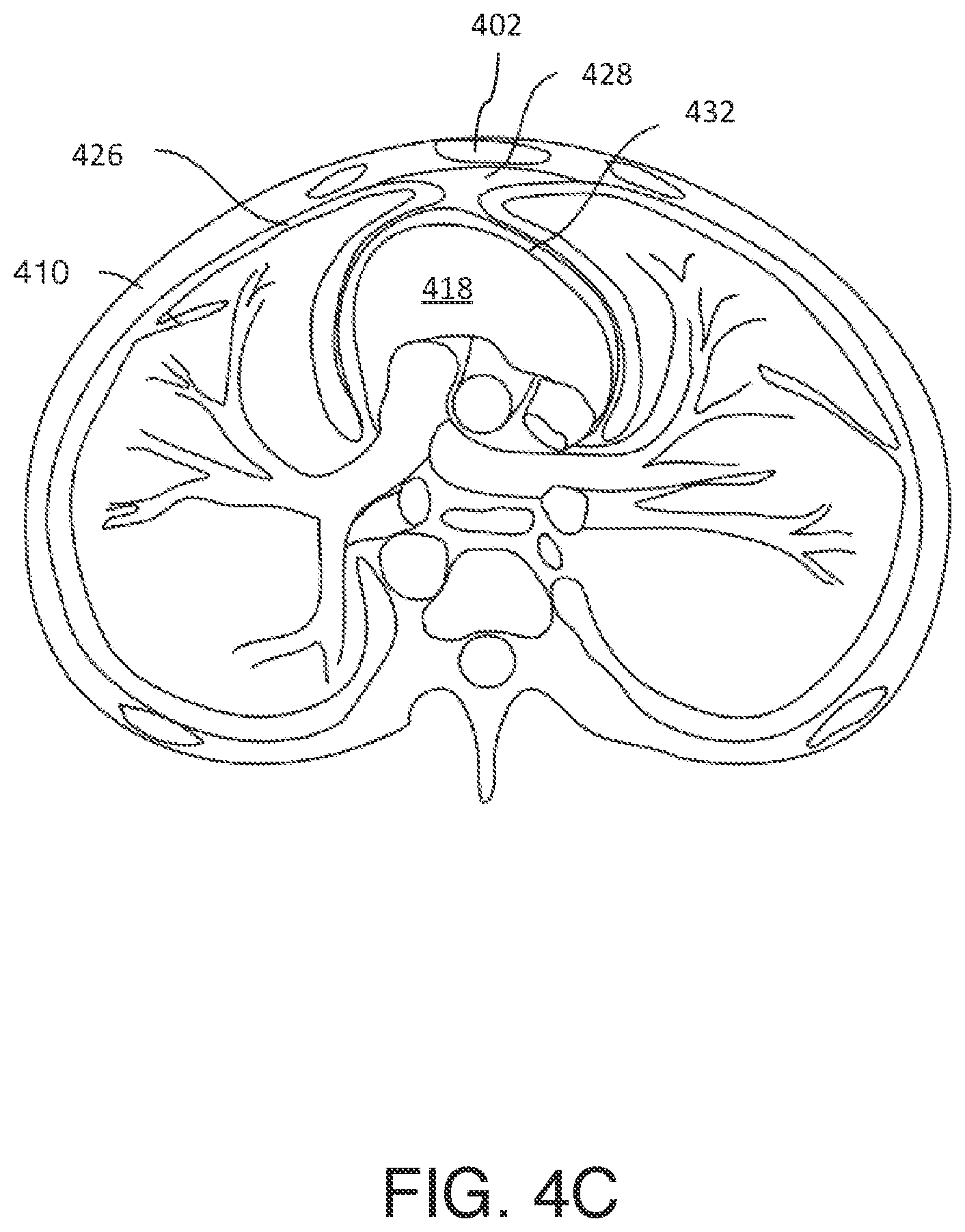 Patent US12303697 Figure 6 – Cardiac pacing sensing and control
