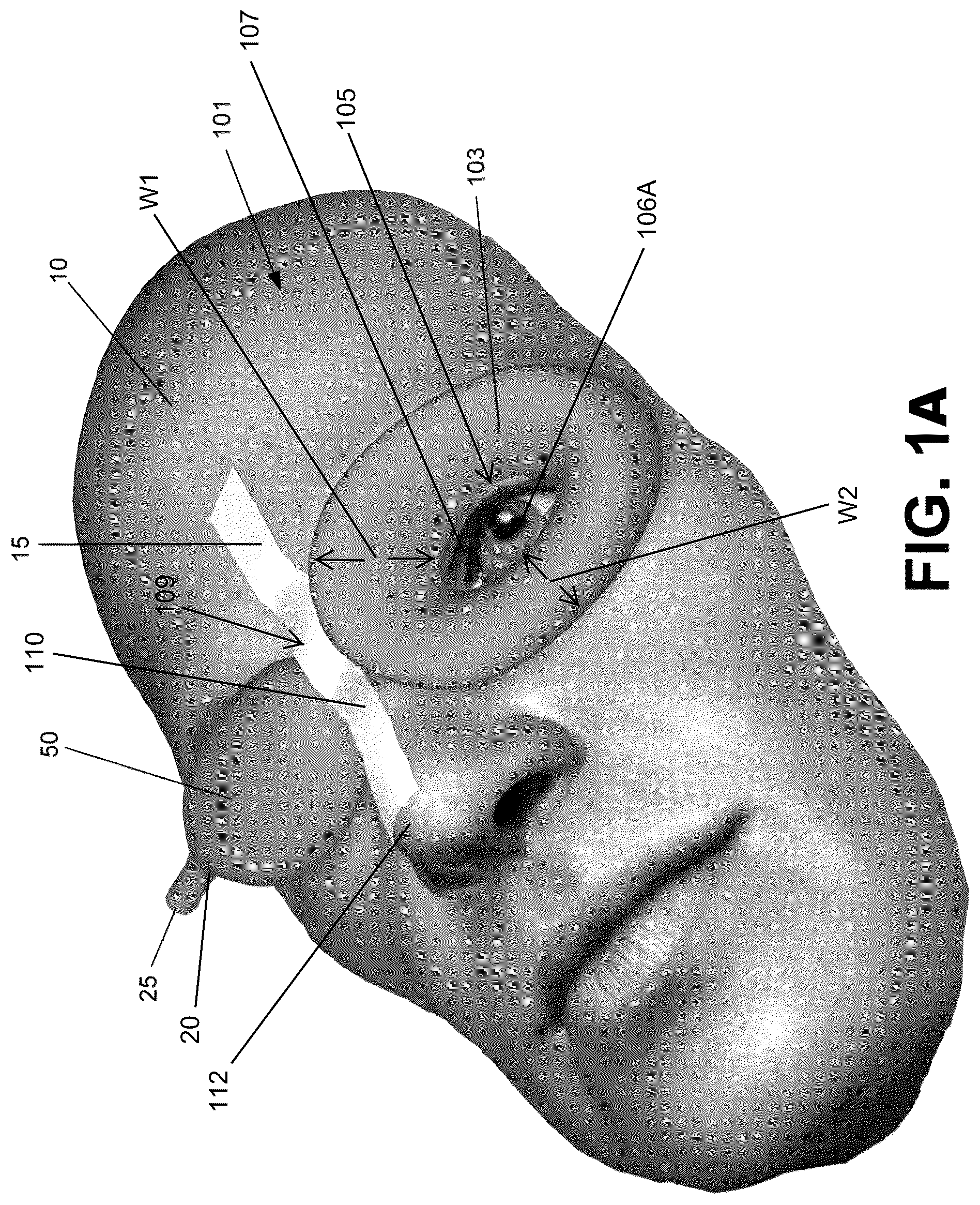 Patent US12303712 Figure 1 – Conformal system for therapeutic beta or low-energy gamma radiation shielding