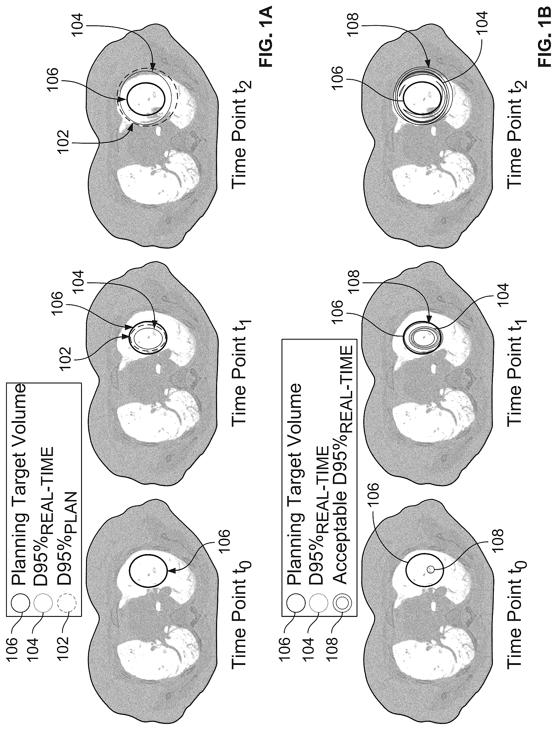 Patent US12303718 — Graphical representation of radiation therapy — Figure 1