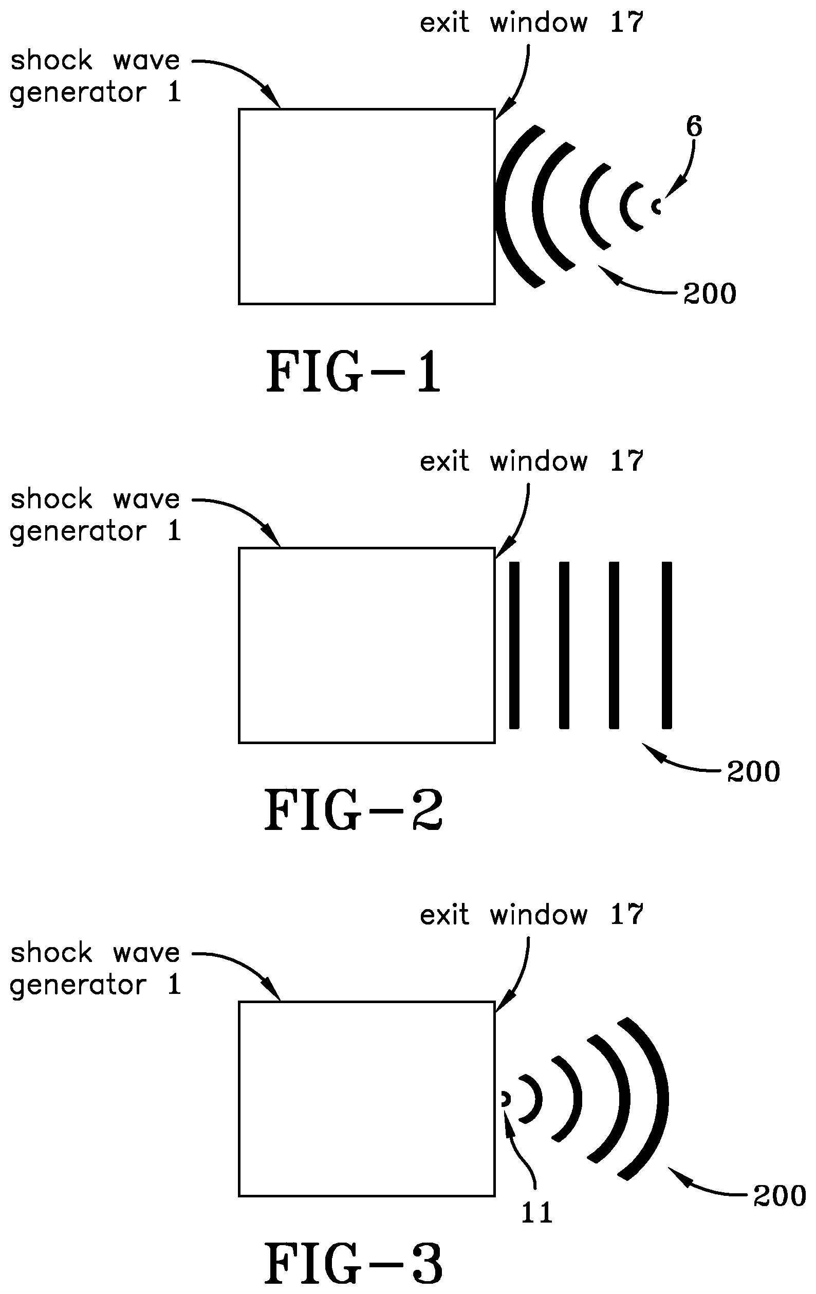 Patent US12303721 Figure 1 – Acoustic shock wave treatment and devices for appendages