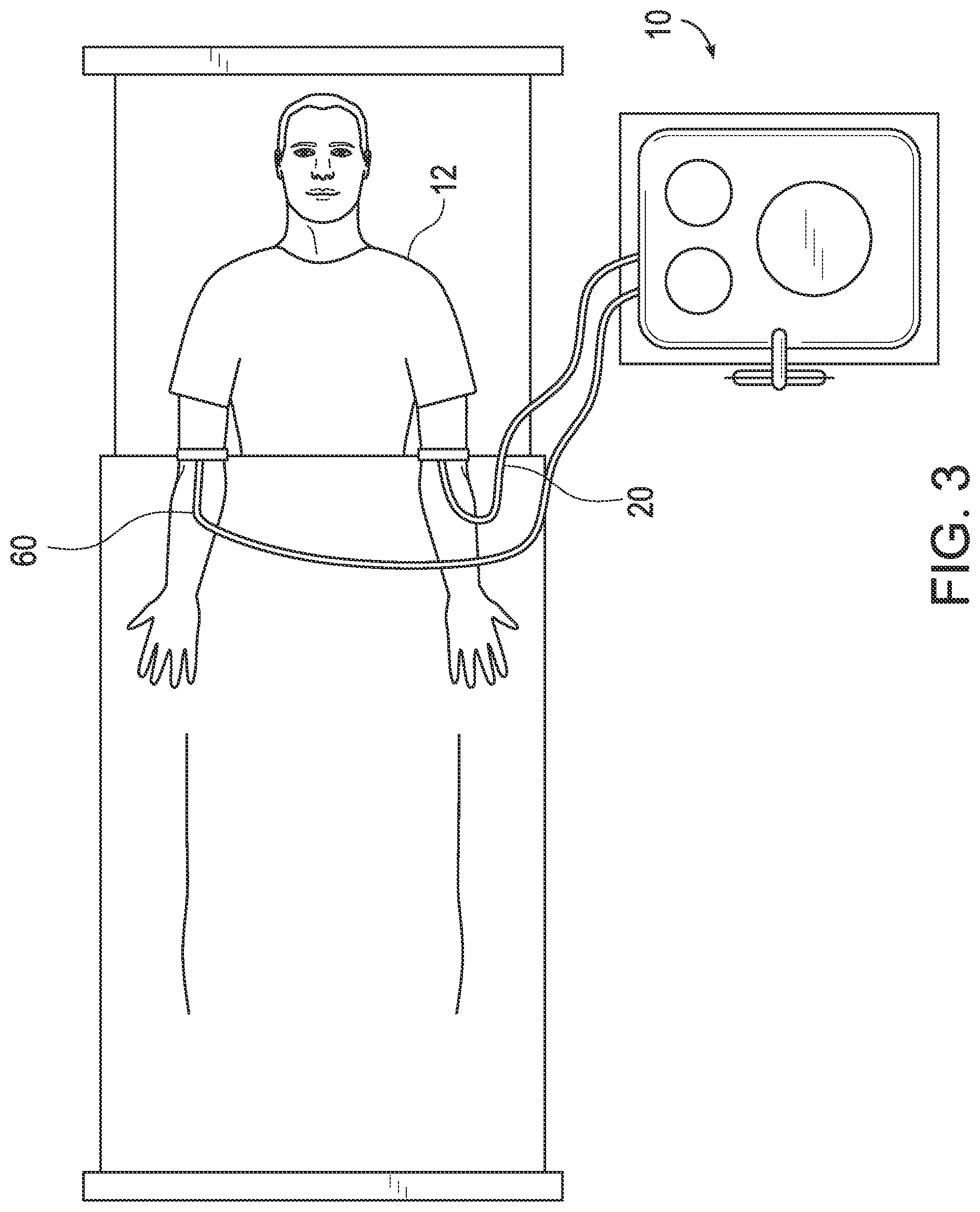 Patent US12303896 Figure 3 – Biological fluid filtration system