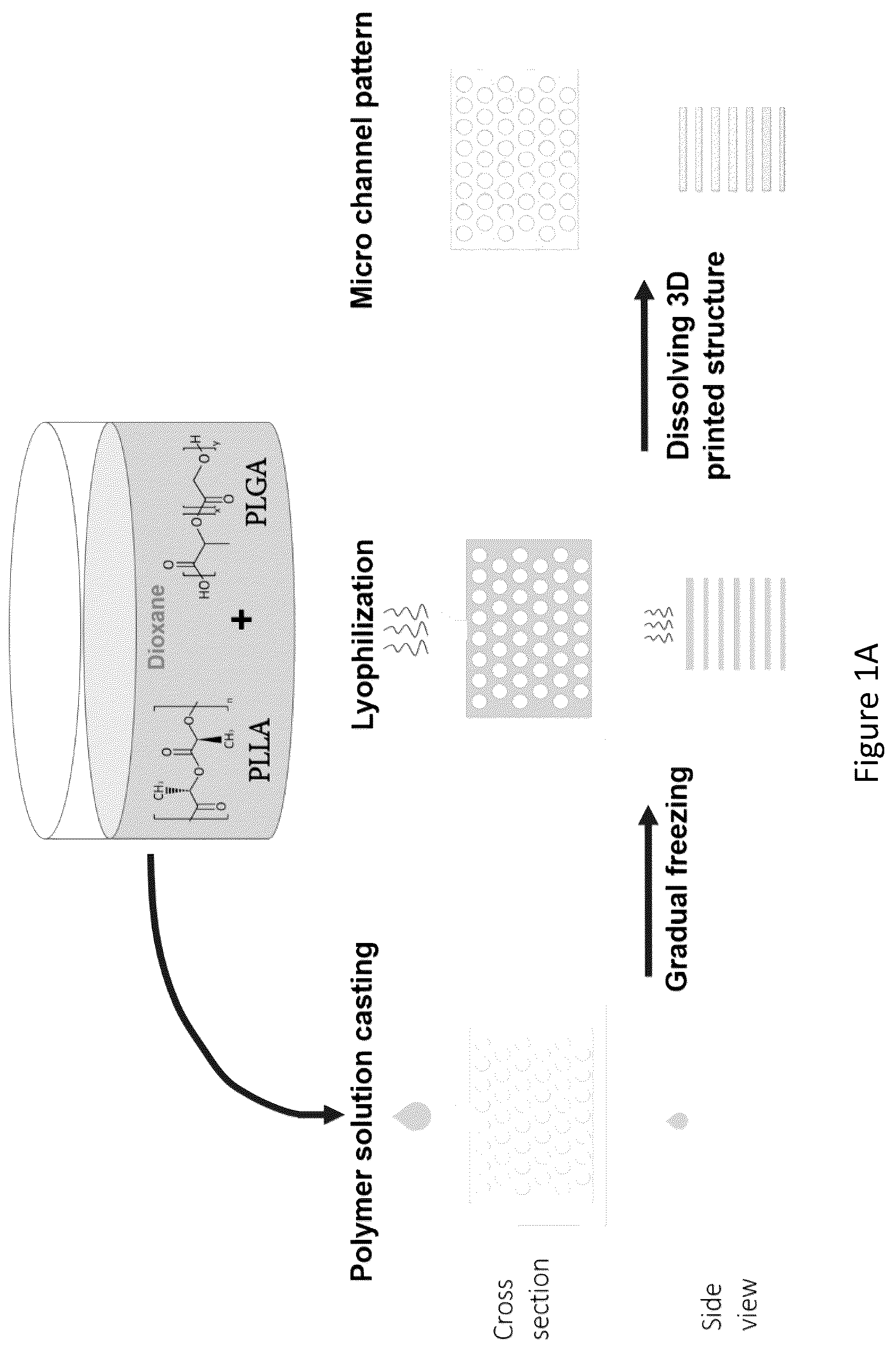 Patent US12304151 Figure 1 – 3D printed biodegradable implants