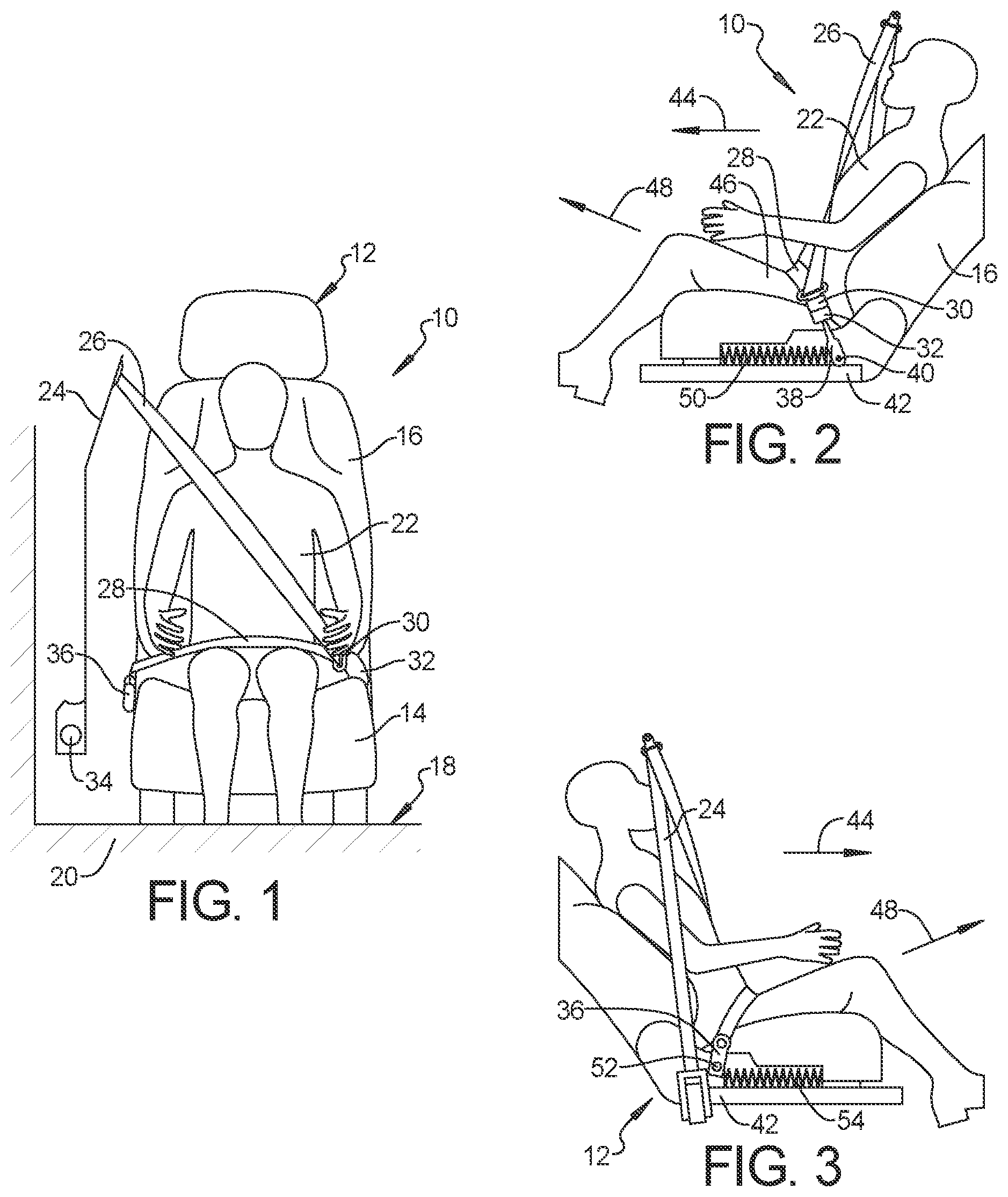 Patent US12304419 — Seatbelt anchorage with energy absorption for frontal impact protection — Figure 1