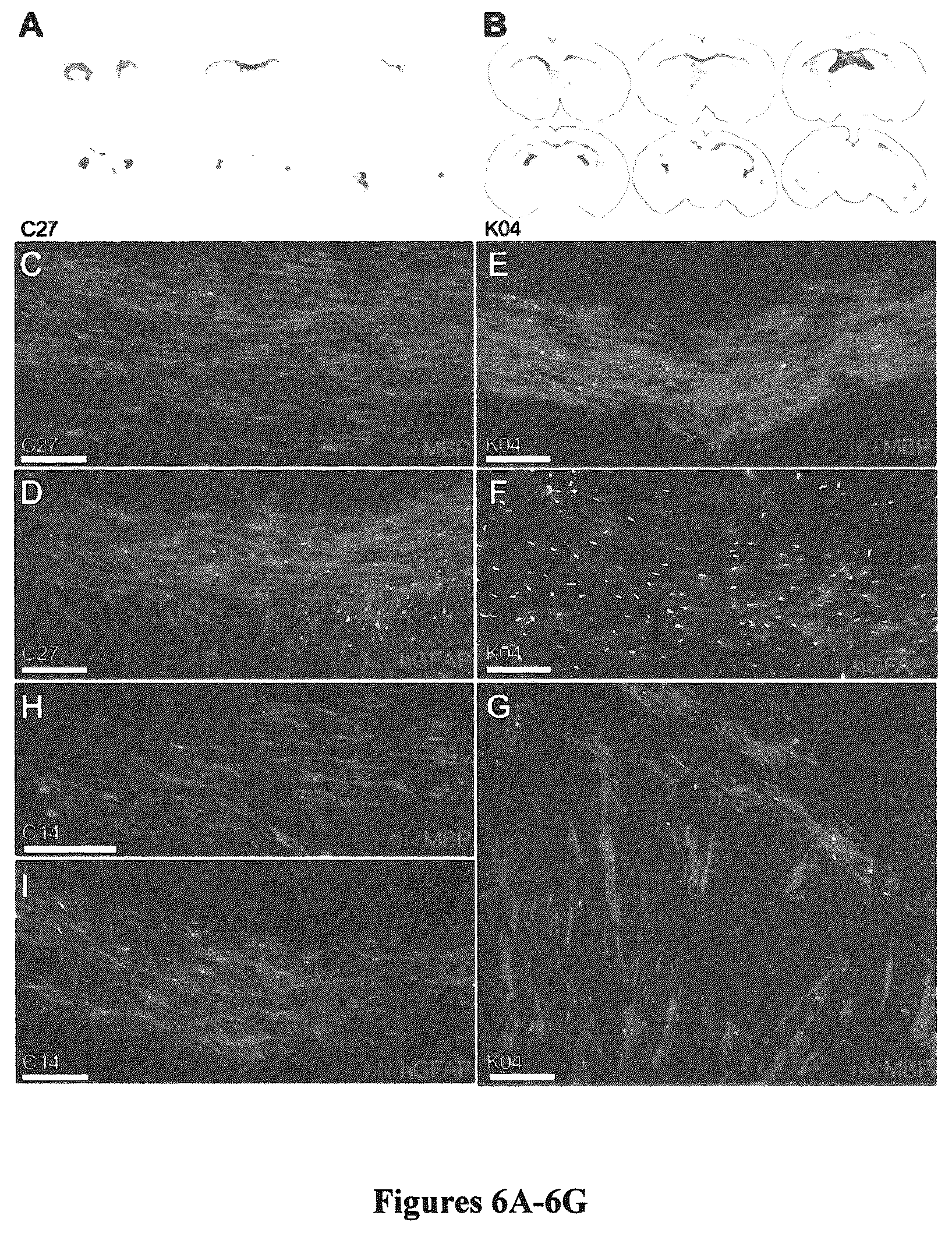 Patent US12305195 Figure 7 – Induced pluripotent cell-derived oligodendrocyte progenitor cells for the treatment of myelin disorders