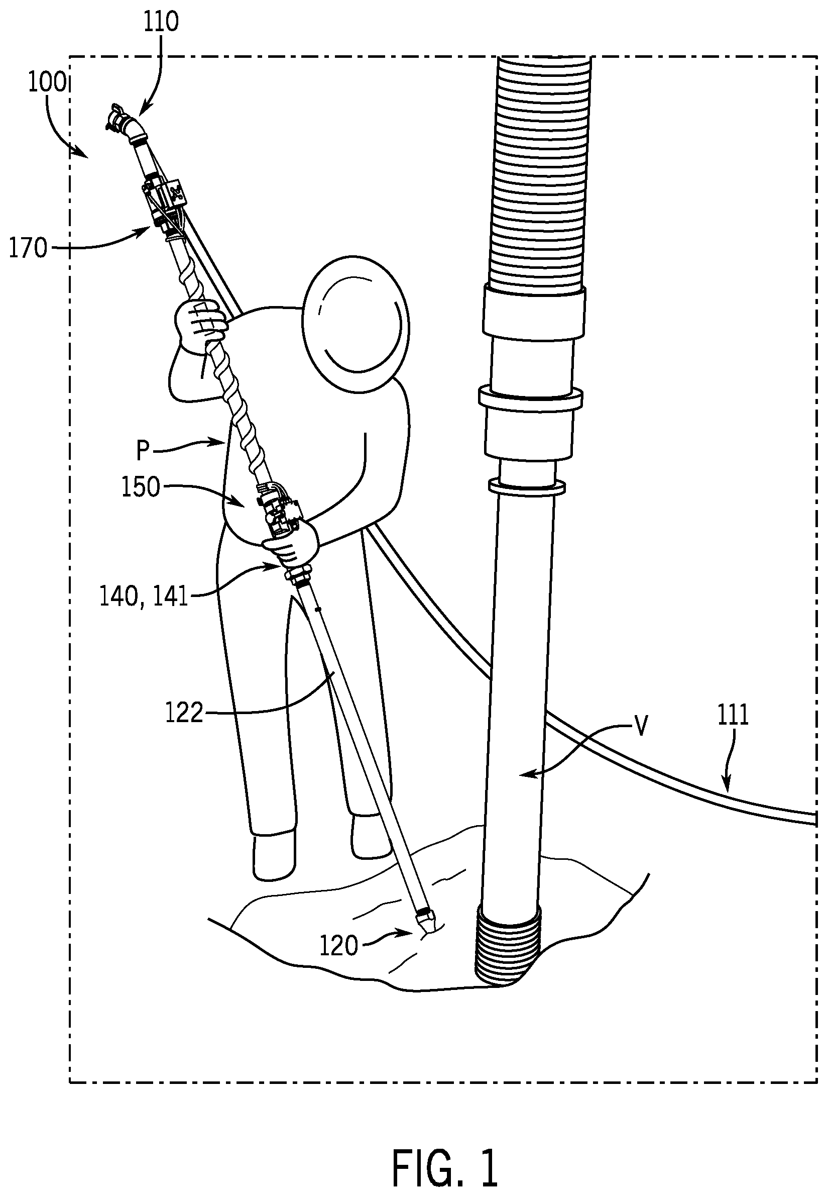 Patent US12305358 Figure 1 – Pneumatic excavator and methods of use
