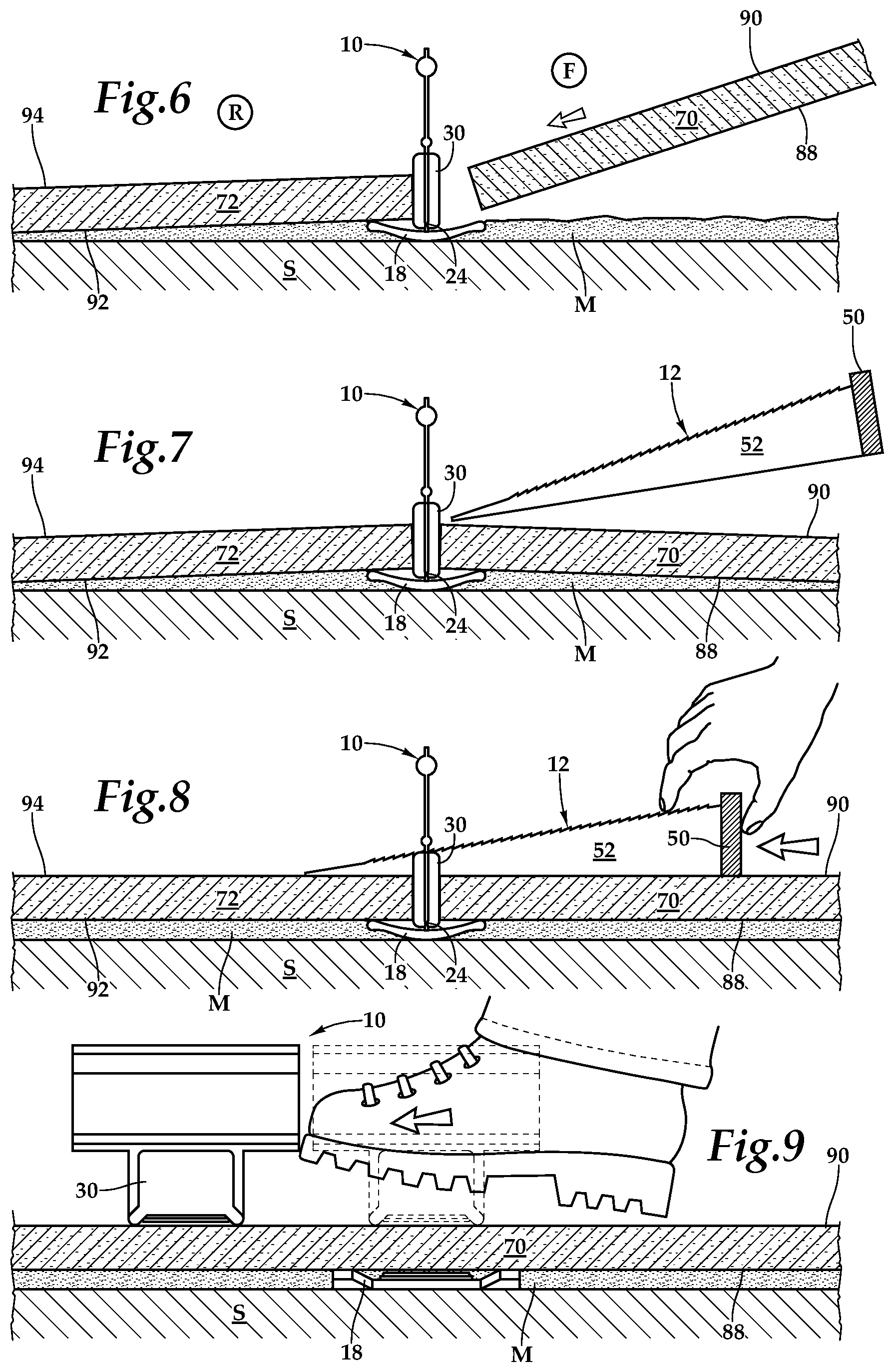 Patent US12305408 Figure 3 – Device for leveling and aligning tiles and method for leveling and aligning tiles