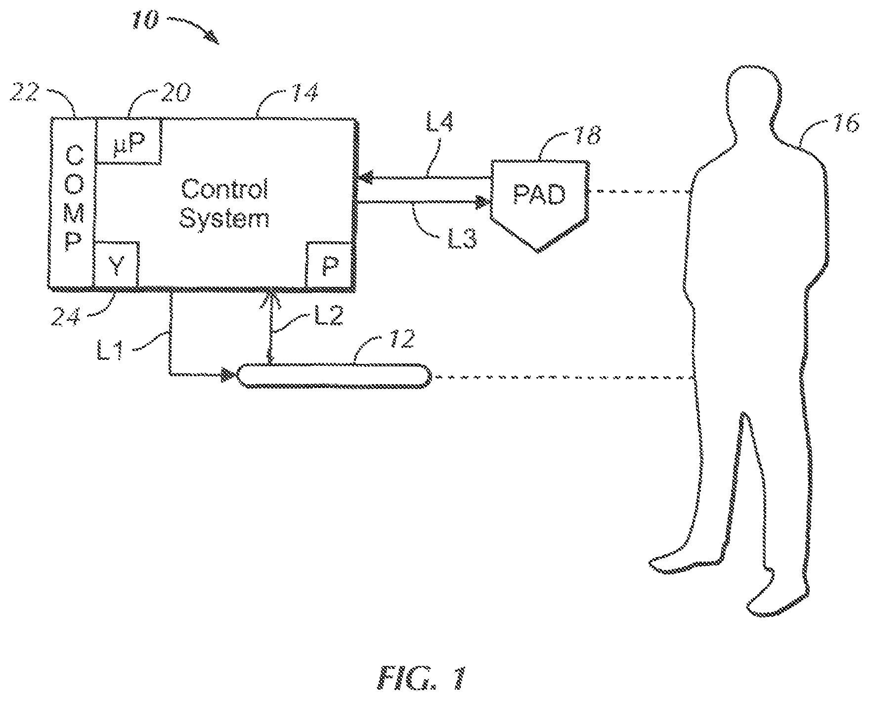 Patent US12305631 — Heat exchange system for patient temperature control with easy loading high performance peristaltic pump — Figure 1
