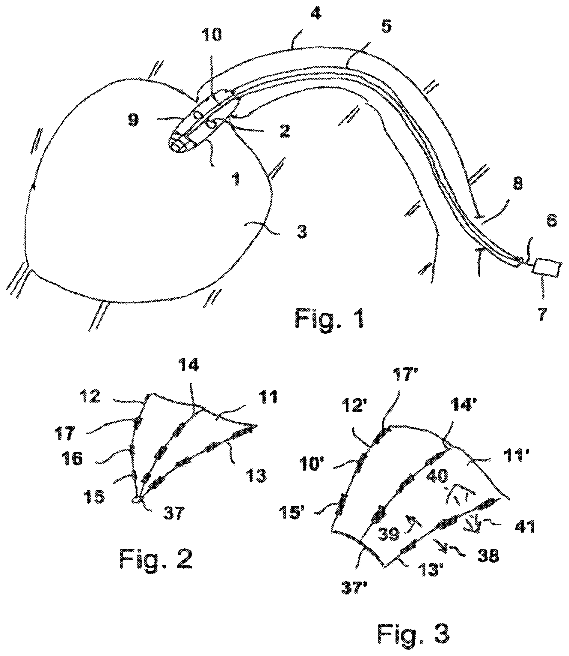 Patent US12305662 Figure 1 – Conveying blades for a compressible rotor