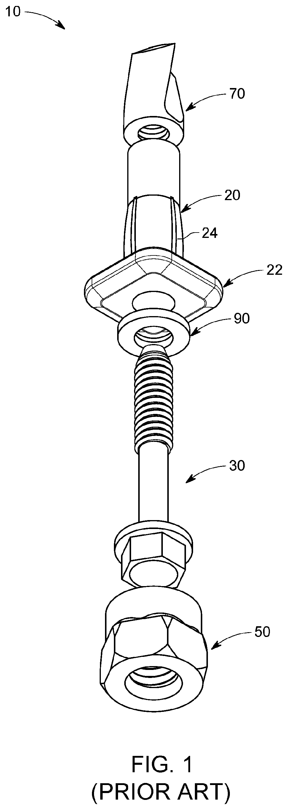 Patent US12305678 — Expandable anchor installation tool and methods of use thereof — Figure 1