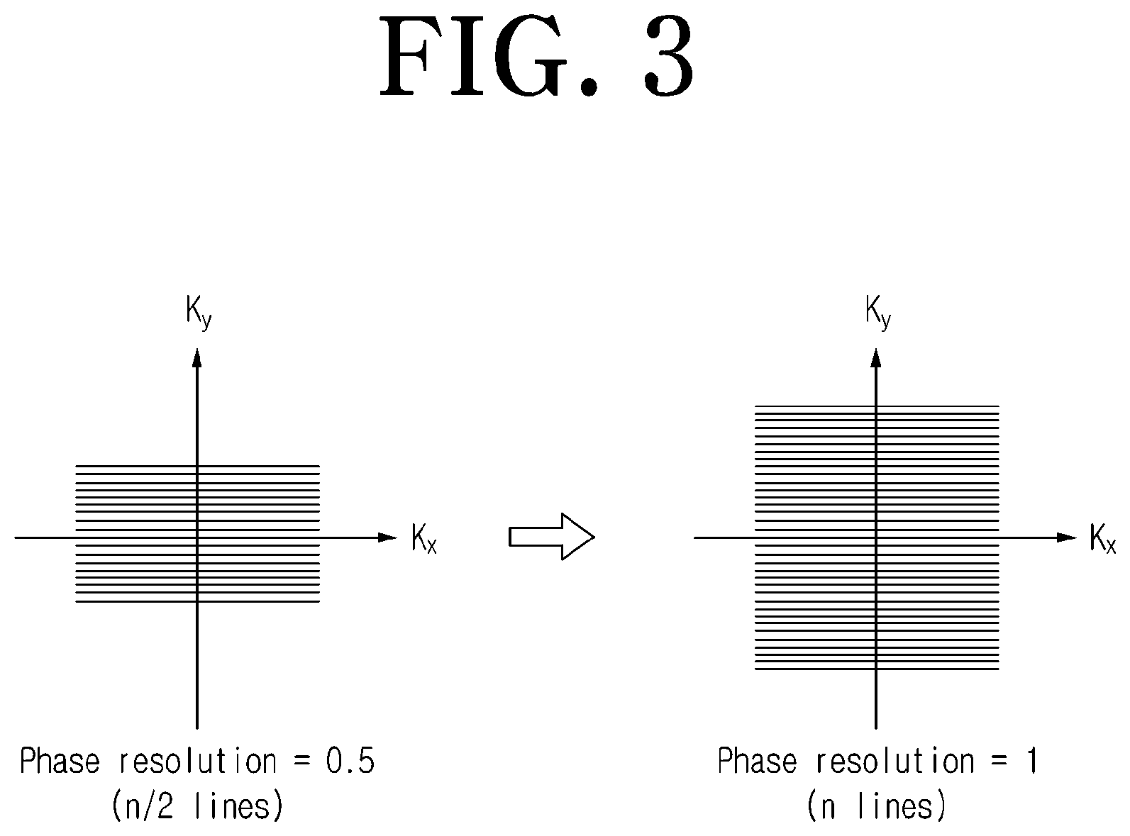 Patent US12306278 Figure 3 – Magnetic resonance image processing apparatus and method to which improvement in slice resolution is applied