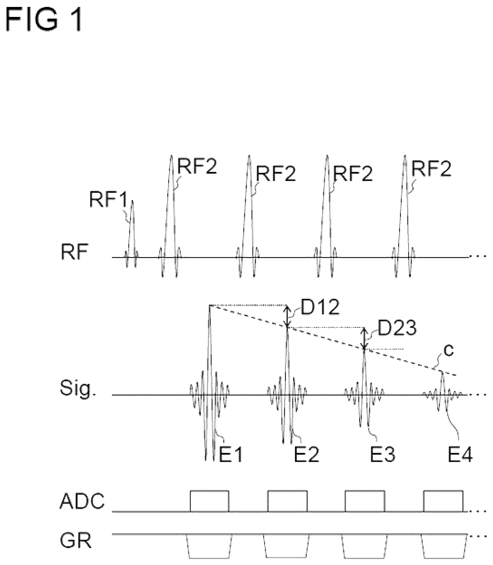 Patent US12306282 — Avoiding artifacts in image data reconstructed from measurement data acquired by means of a turbo spin echo sequence — Figure 1