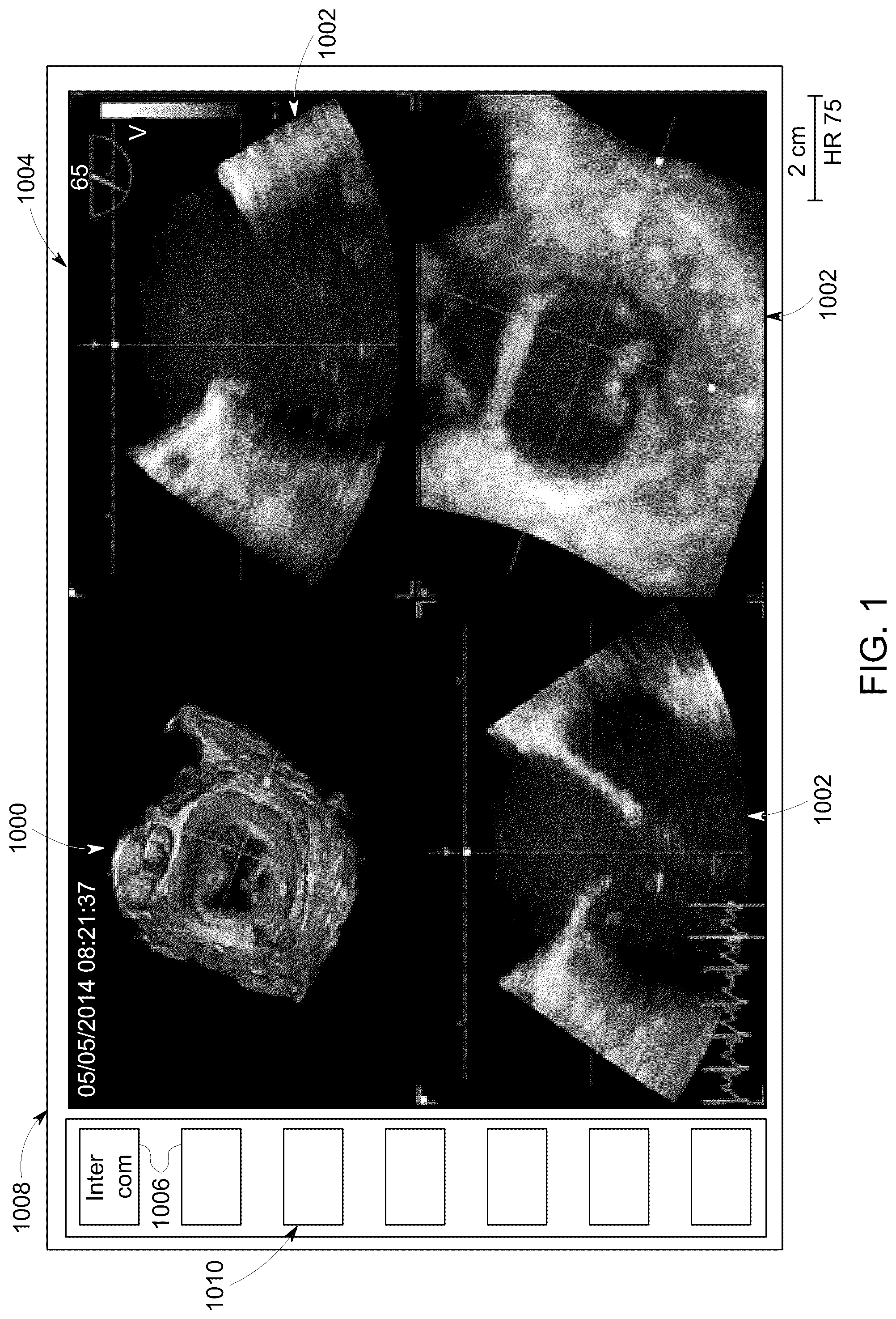 Patent US12307556 Figure 1 – Automatic model-based navigation system and method for ultrasound images