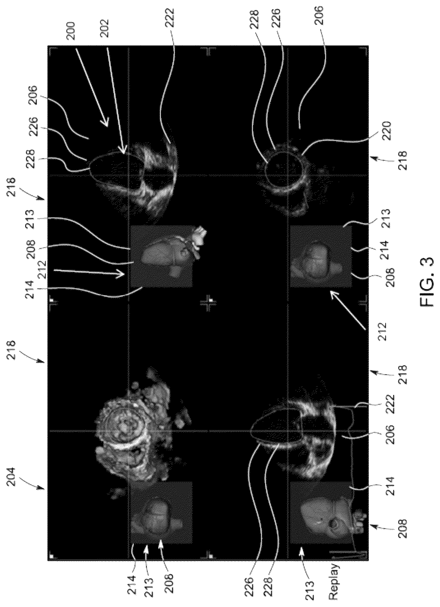 Patent US12307556 Figure 3 – Automatic model-based navigation system and method for ultrasound images