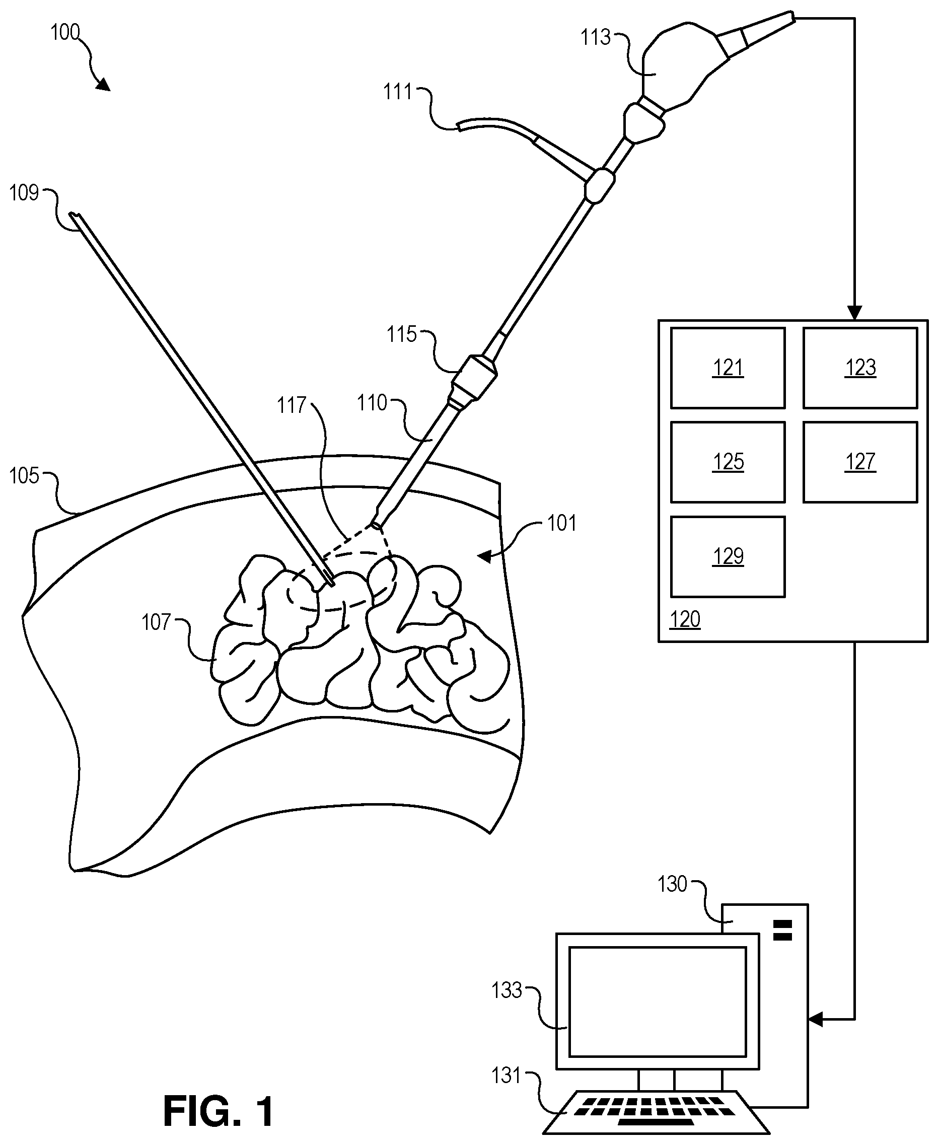Patent US12307636 Figure 1 – Specular reflection reduction in endoscope visualization