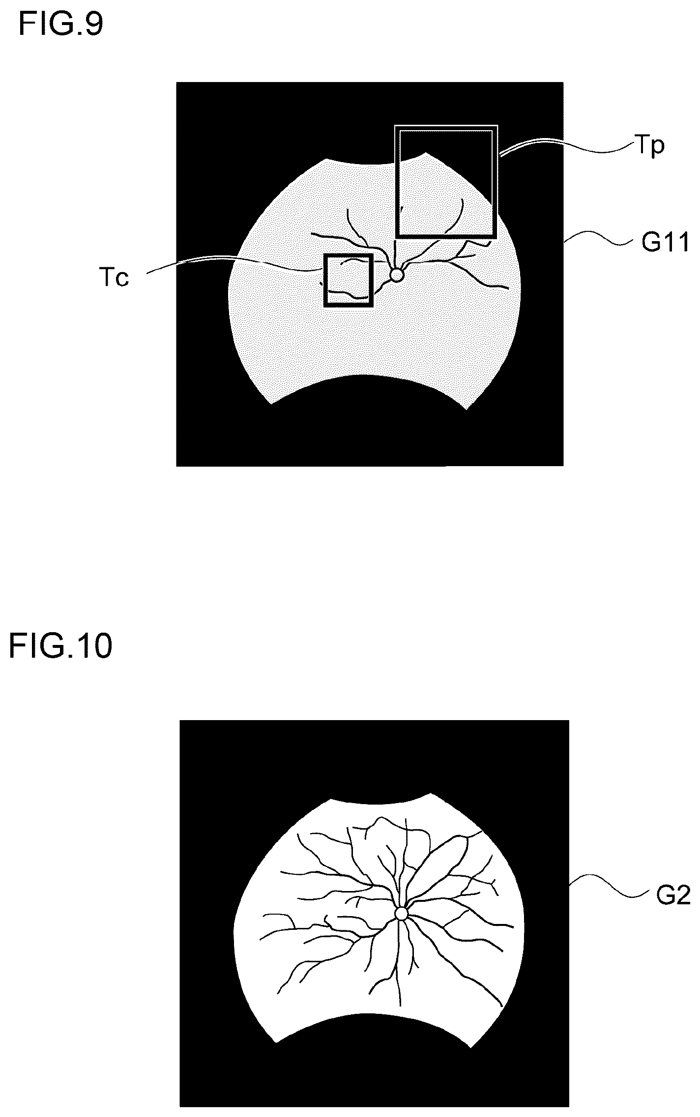 Patent US12307639 Figure 10 – Image processing method, image processing device, and program
