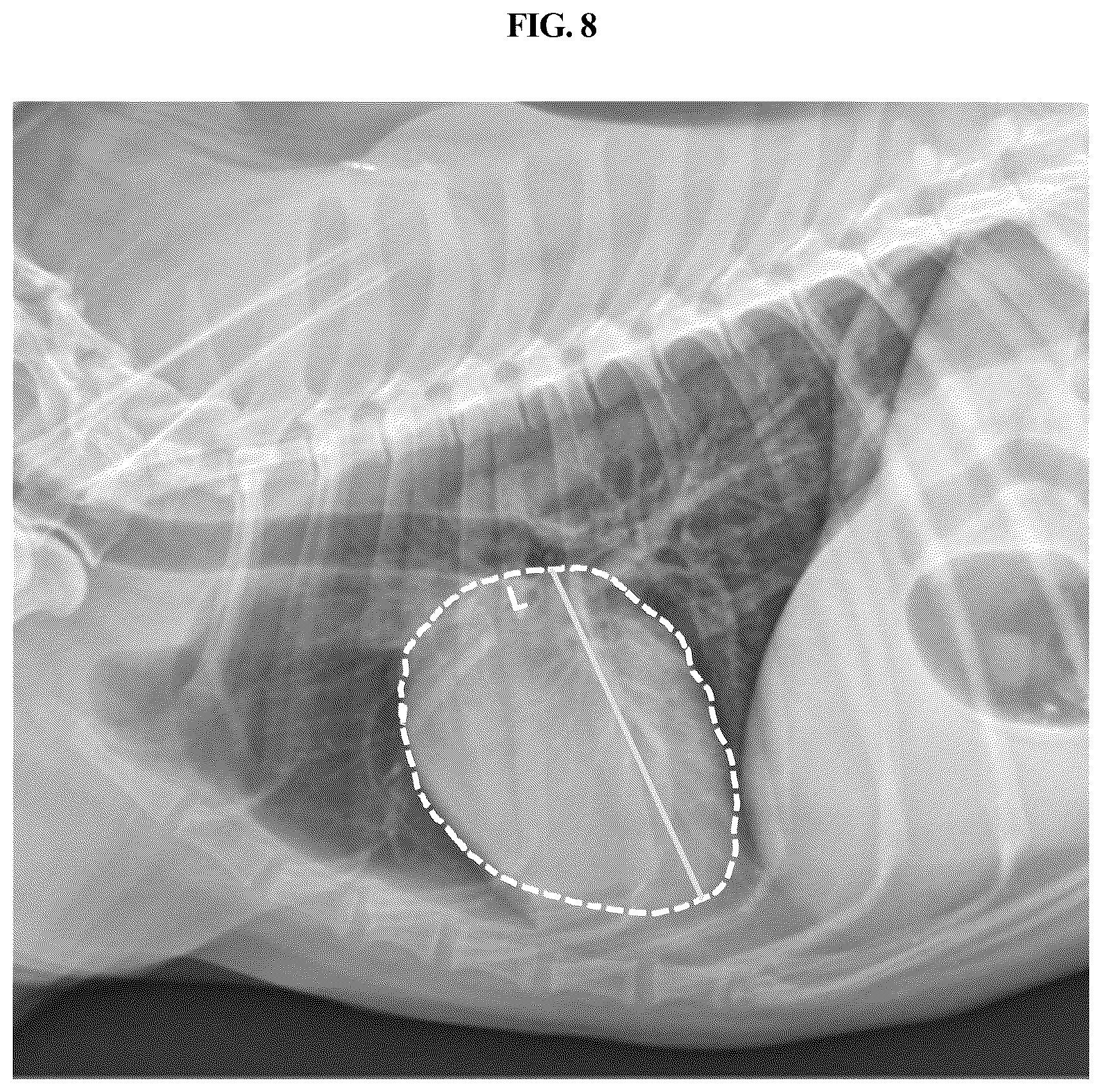 Patent US12307665 Figure 8 – Method and device for quantifying size of tissue of interest of animal by using X-ray image of animal