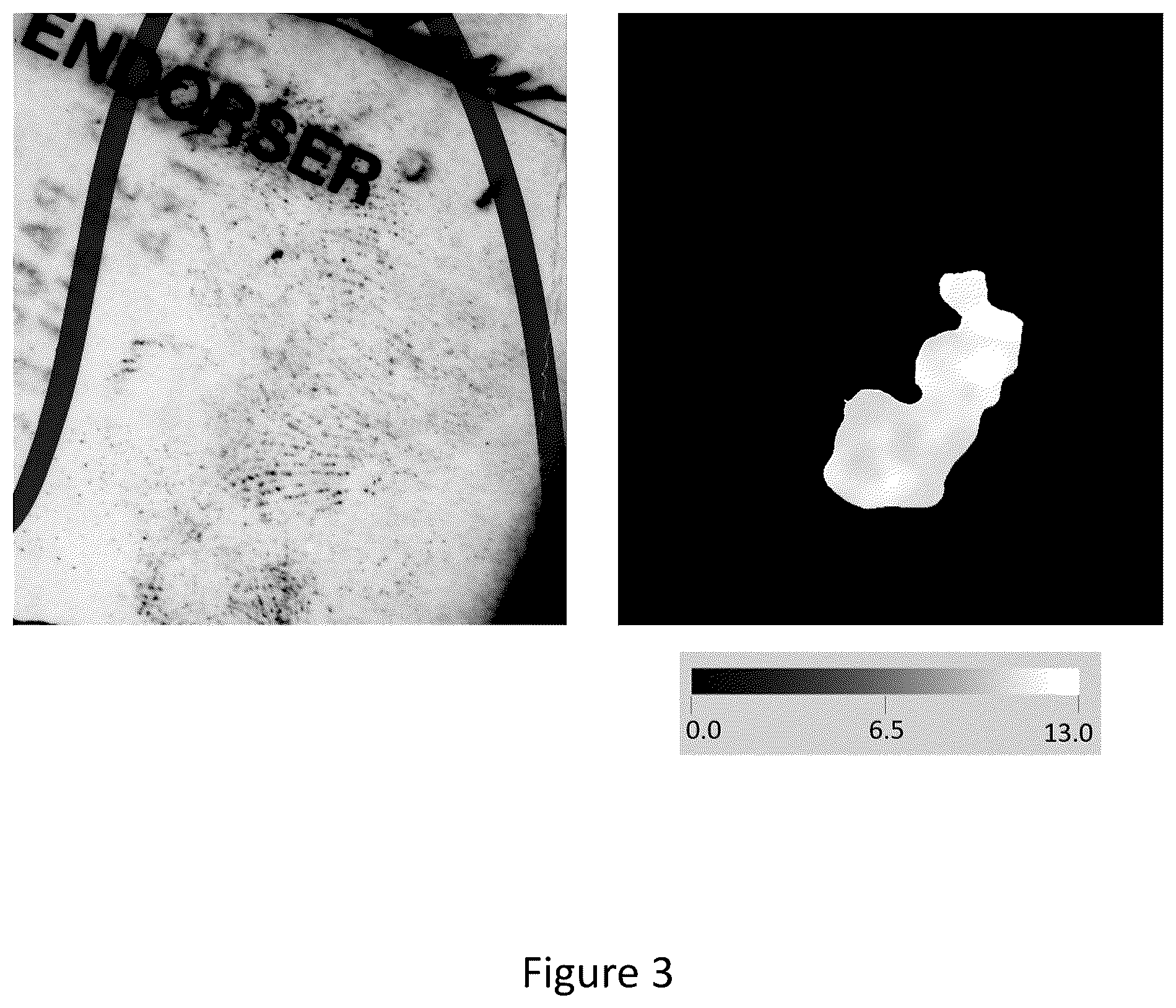 Patent US12307806 Figure 2 – Method using inter-ridge distances in pixels relating to fingerprints
