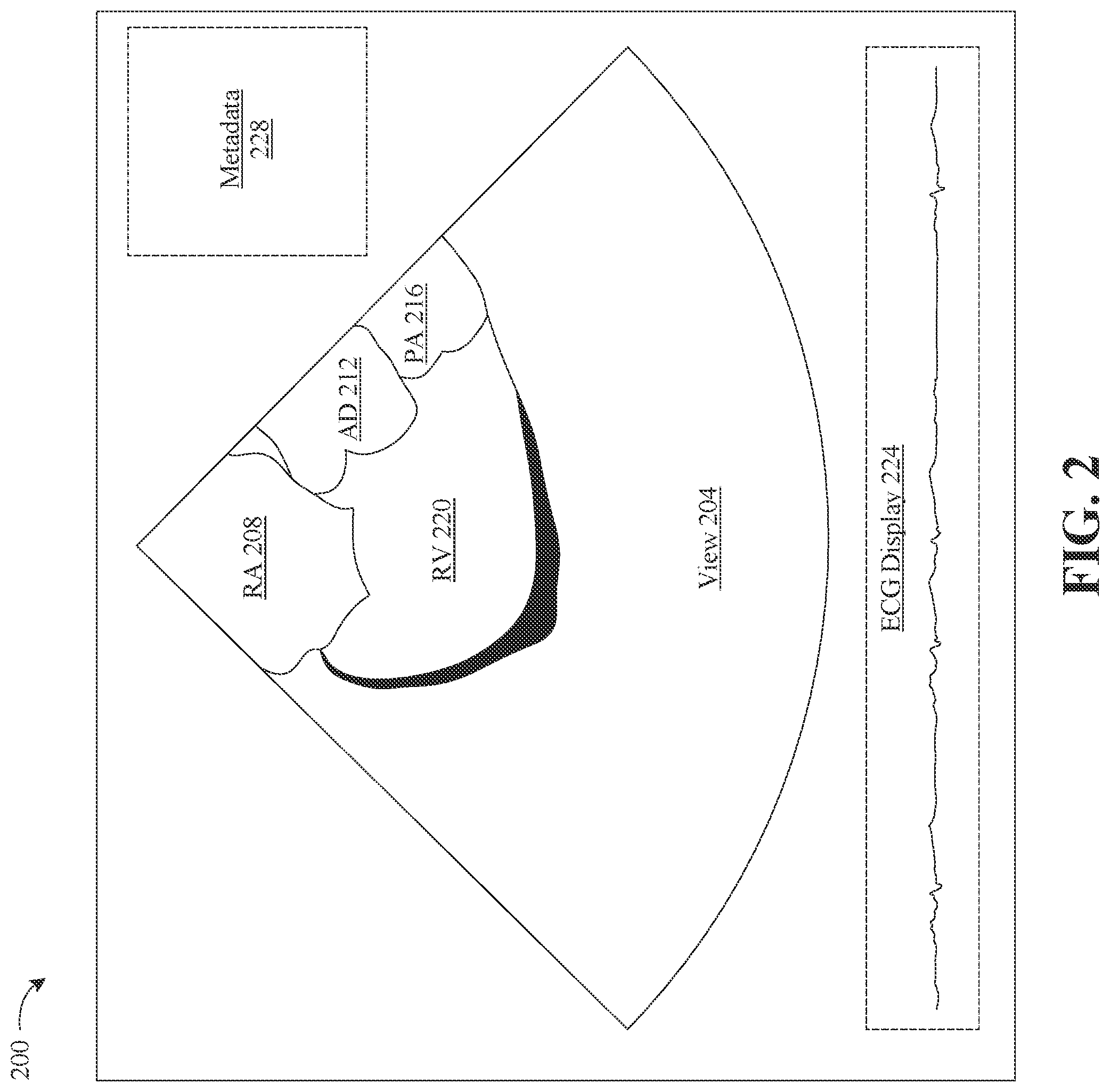 Patent US12308113 Figure 2 – Apparatus and methods for synthetizing medical images