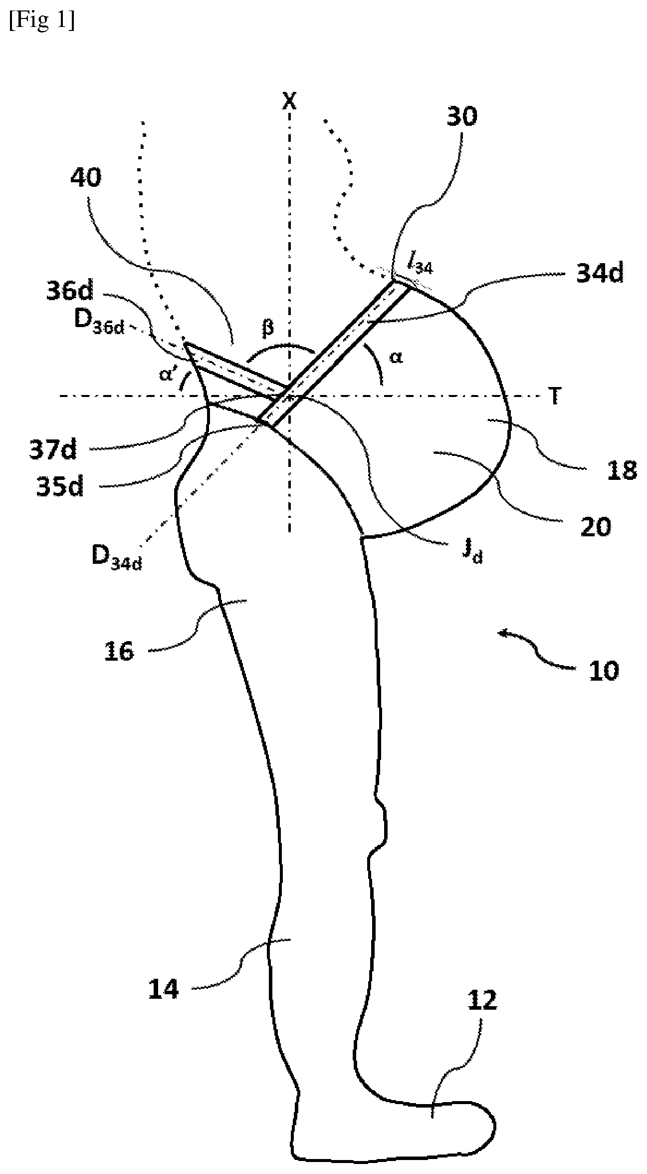 Patent US12310426 — Textile device for pregnant women — Figure 1