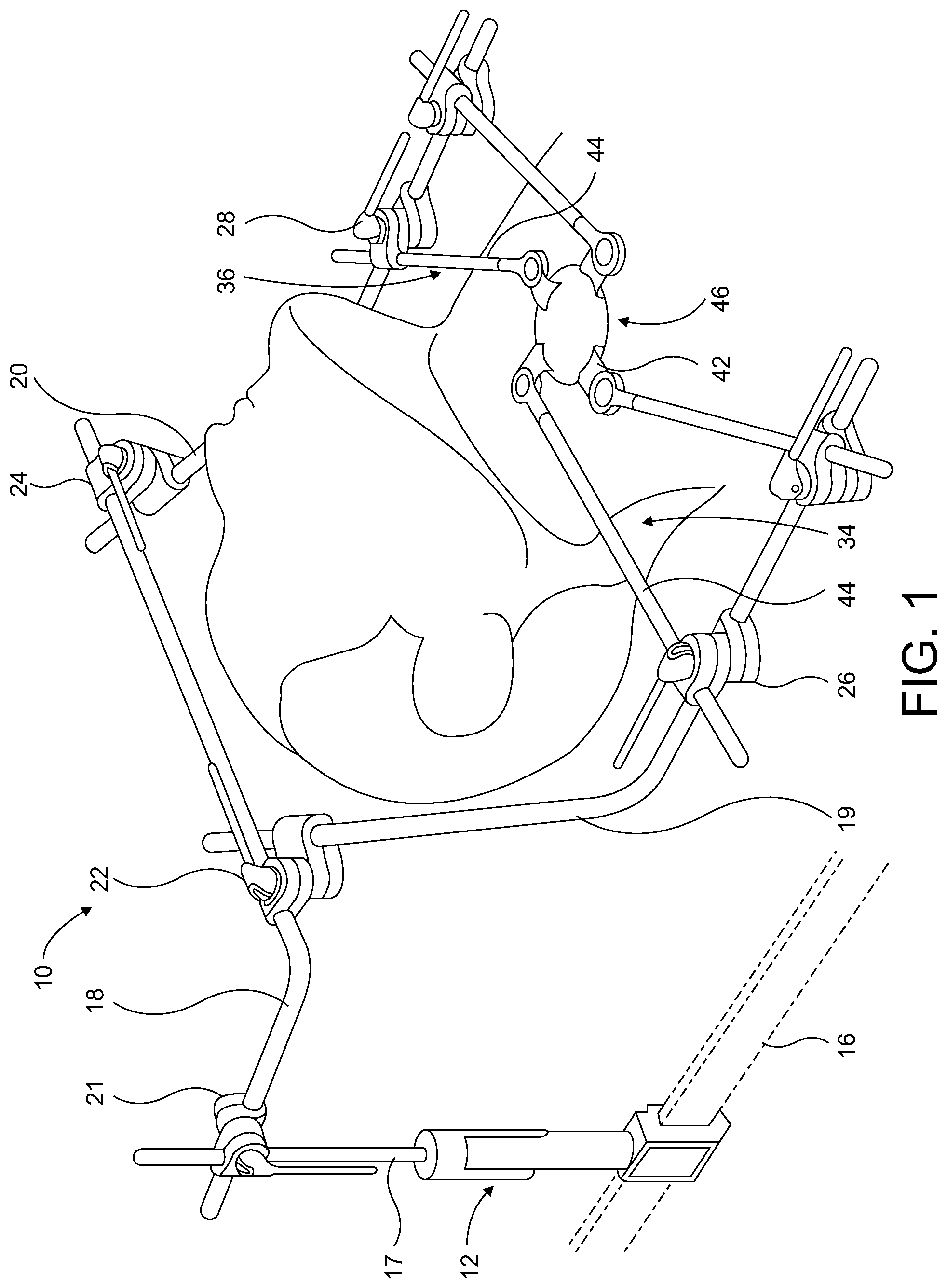 Patent US12310569 — Surgical retractor having clamping mechanism — Figure 1