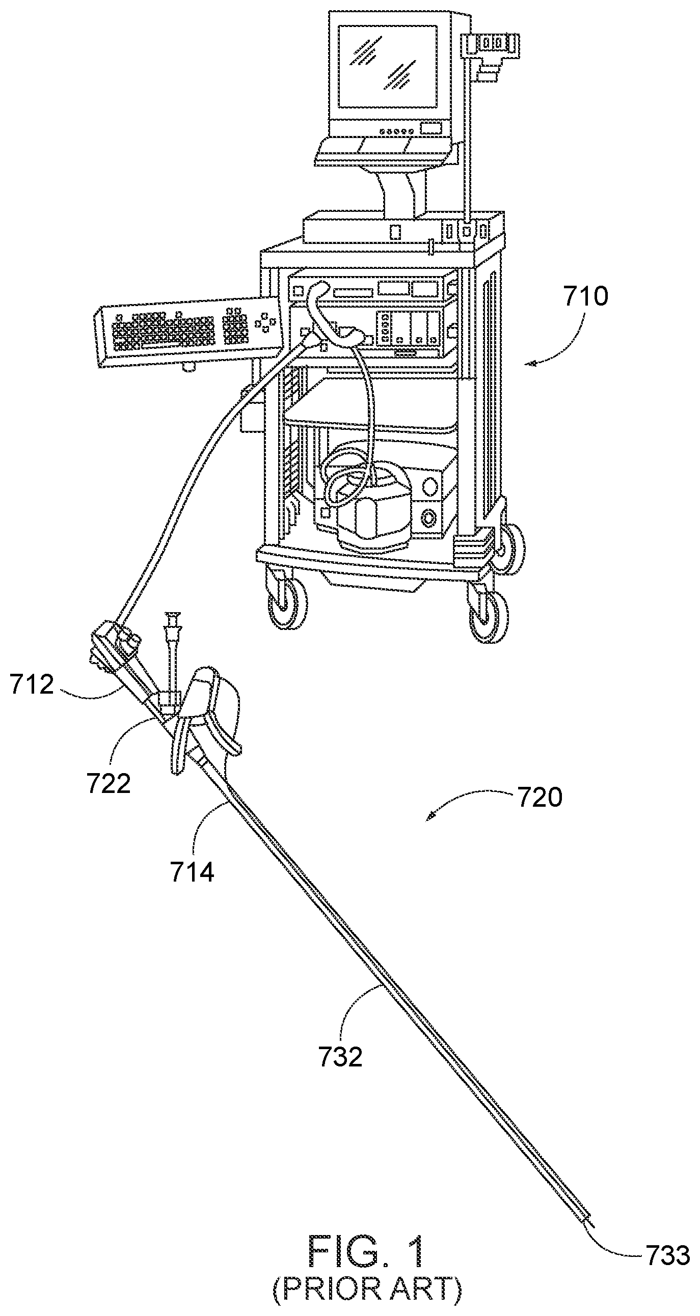 Patent US12310578 Figure 1 – Endoscopic suture loop anchors and methods
