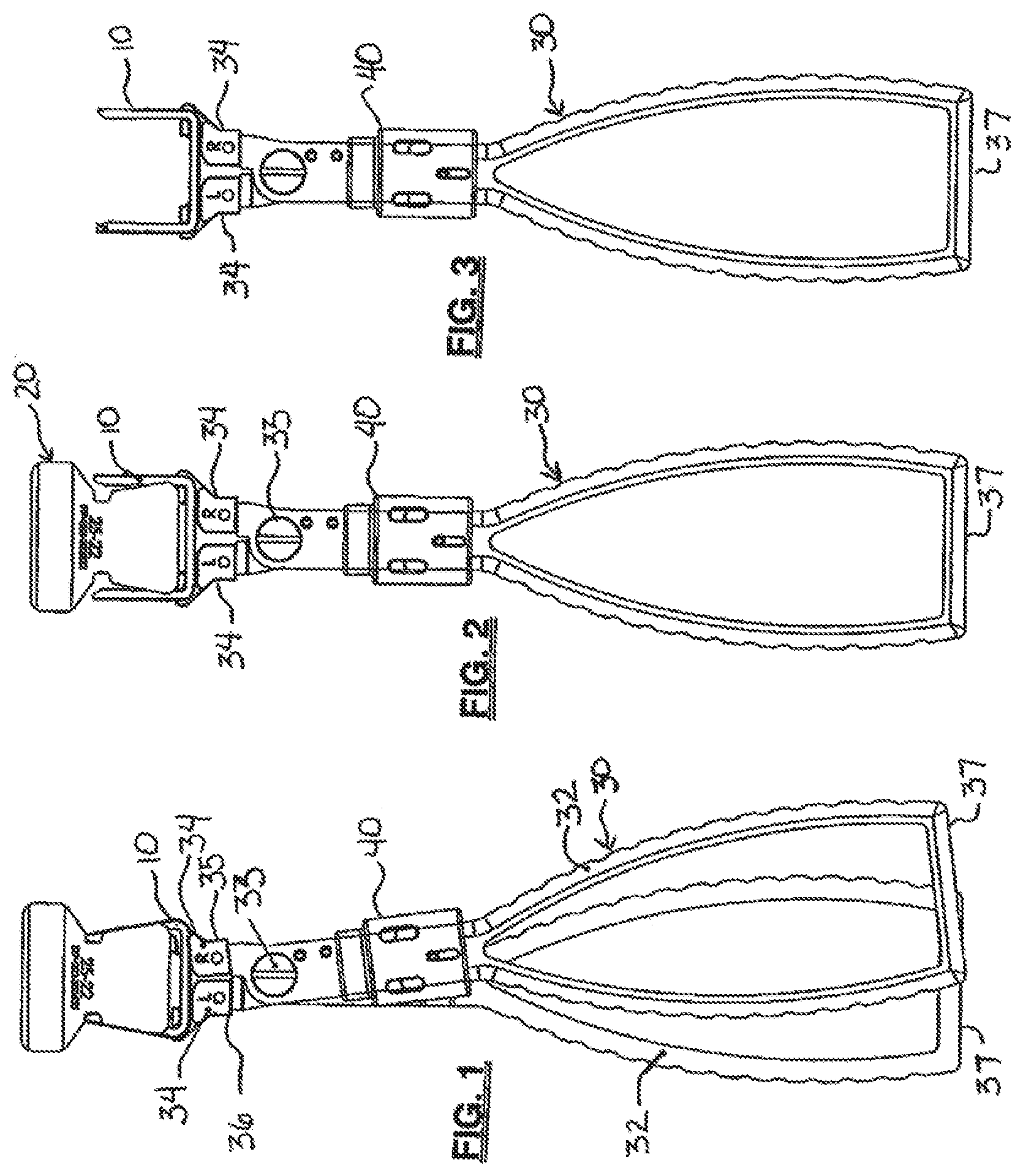 Patent US12310580 — Bone staple storage, inserter, and method for use therewith — Figure 1