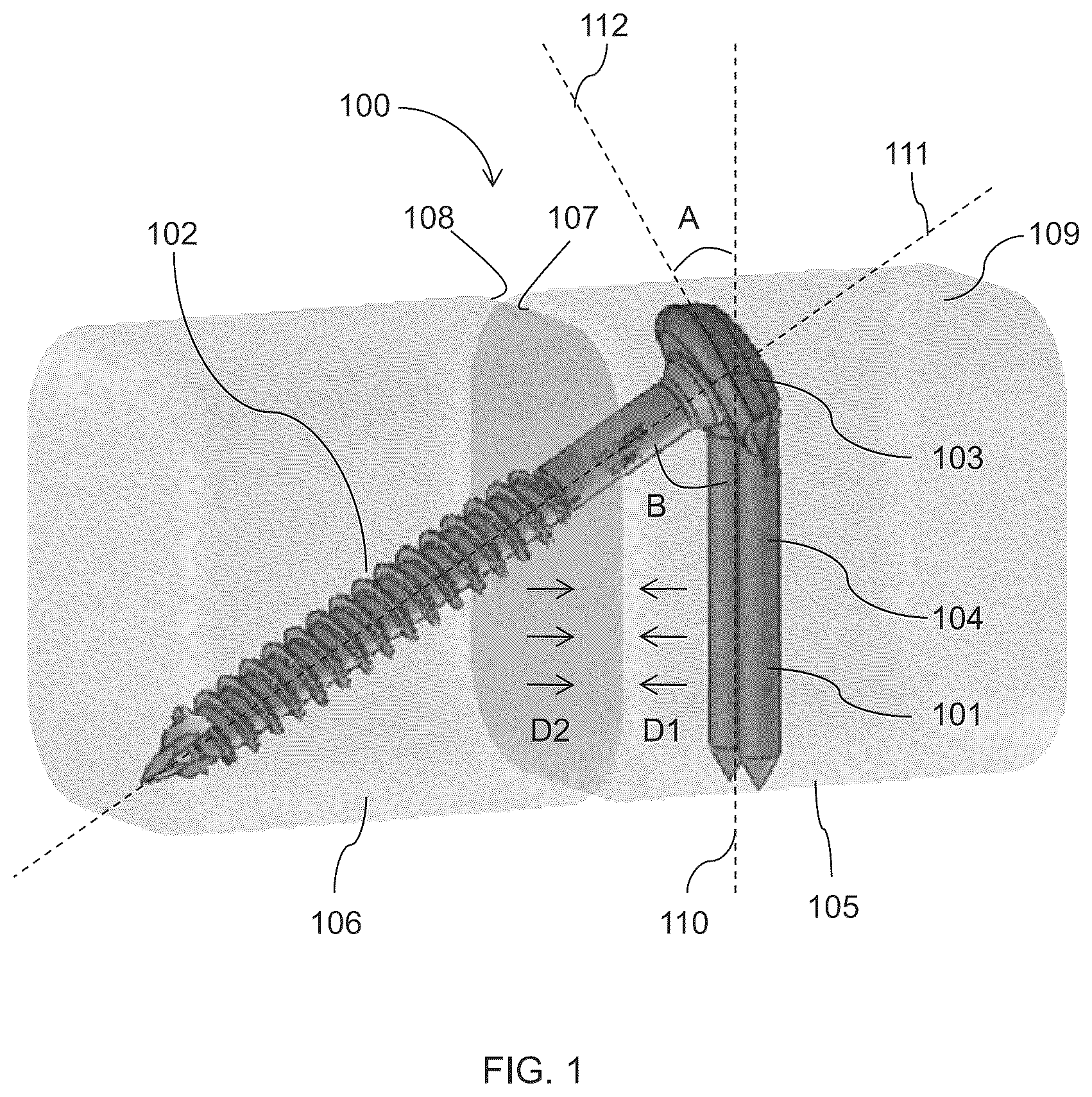 Patent US12310581 — Fixation assembly and method of use — Figure 1