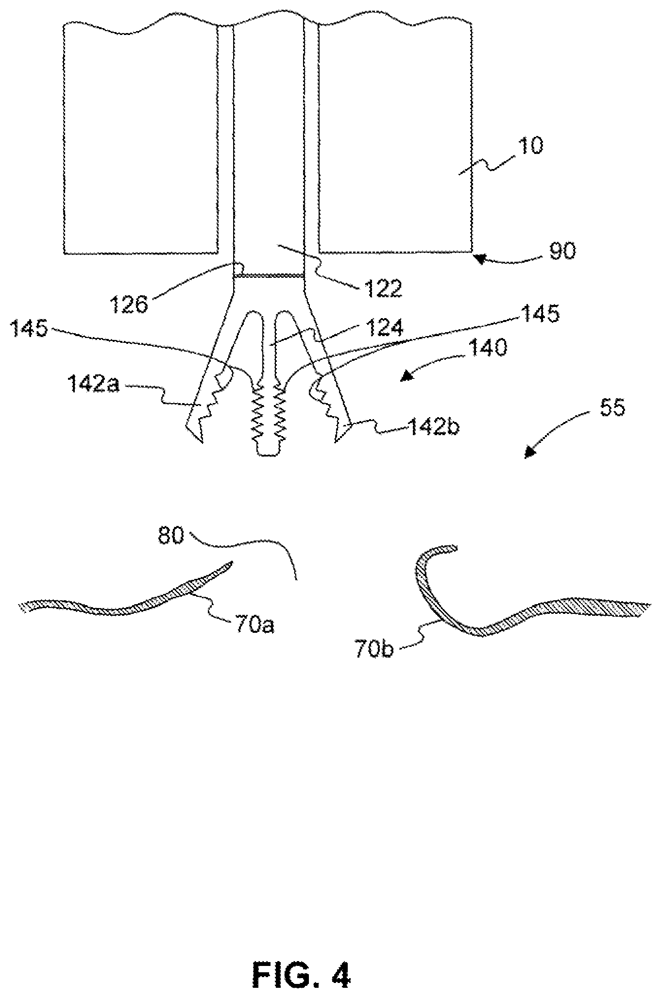Patent US12310588 Figure 5 – Devices for approximating tissue and related methods of use